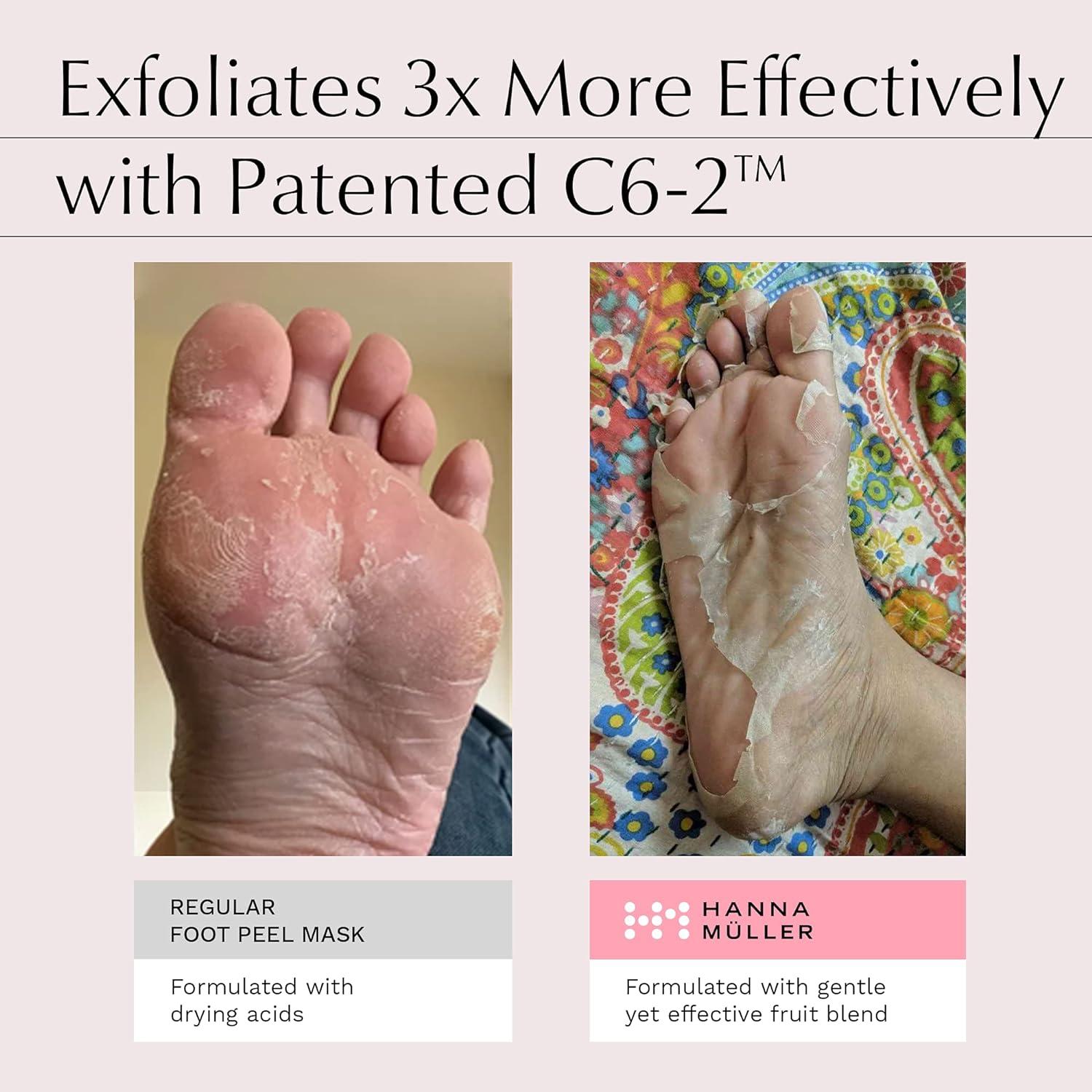 Foot Peel Mask for Hard Skin and Cracked Heels Exfoliating Foot