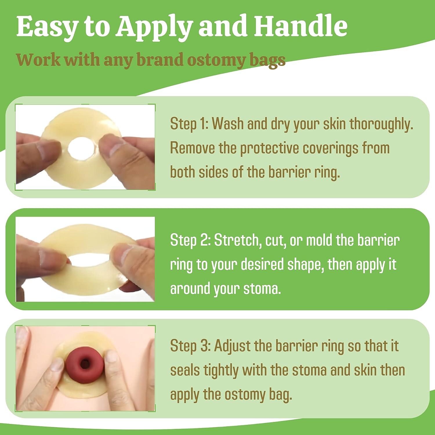 Elastic Moldable Ostomy Barrier Rings Outer Diameter 2" (48mm) 4mm