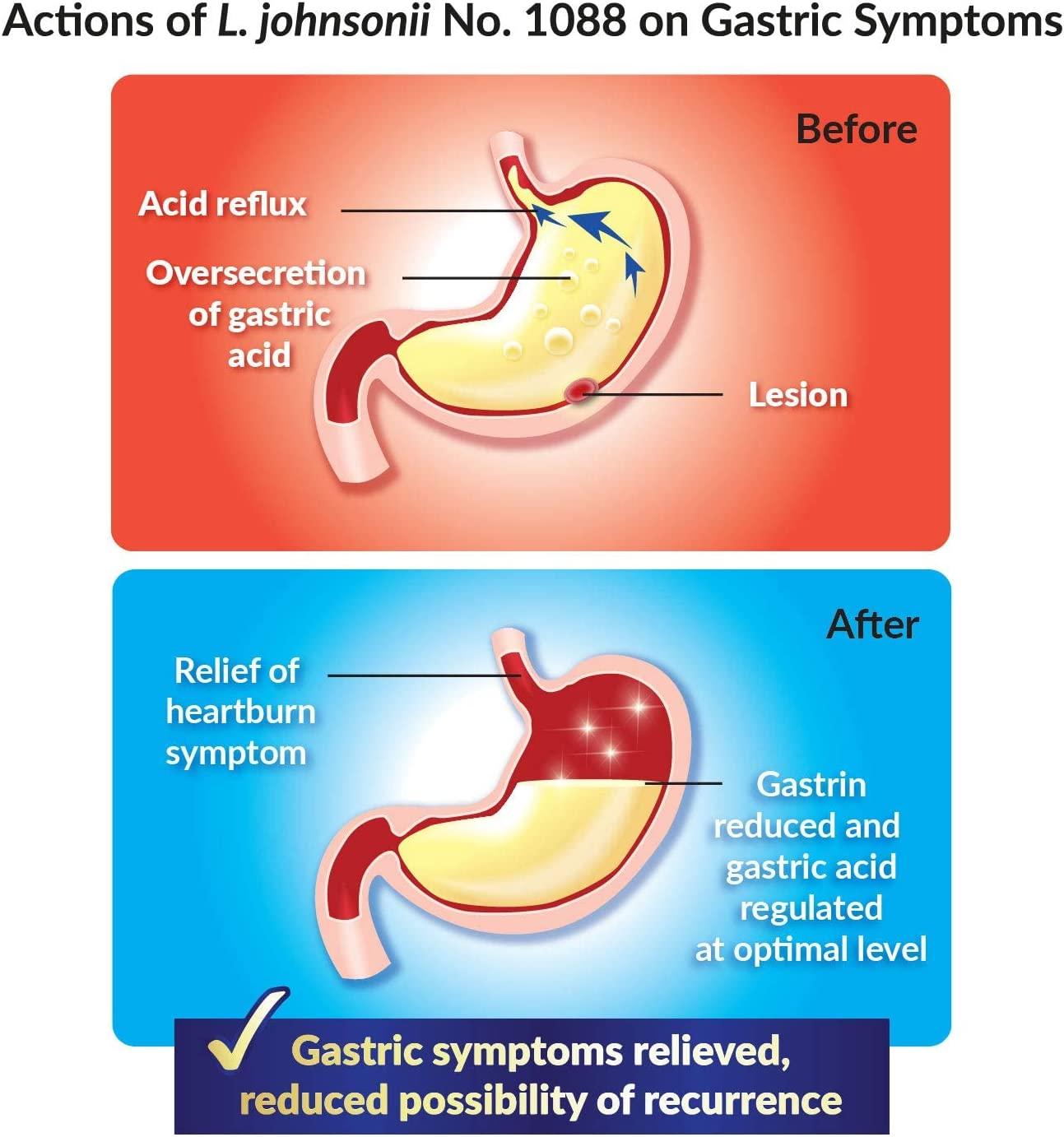GASTRICELL Eliminate H. Pylori, Relieve Acid Reflux and Heartburn