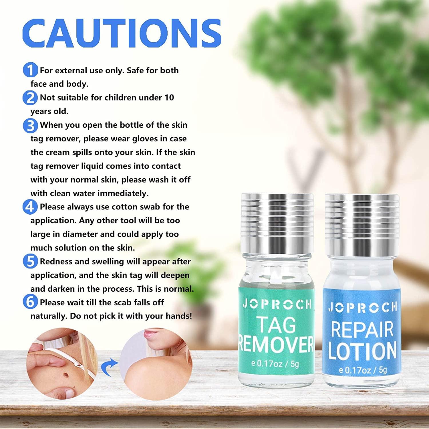 Skin Tag Remover All Natural Mole and Skin Tag Removal Lotion Scar