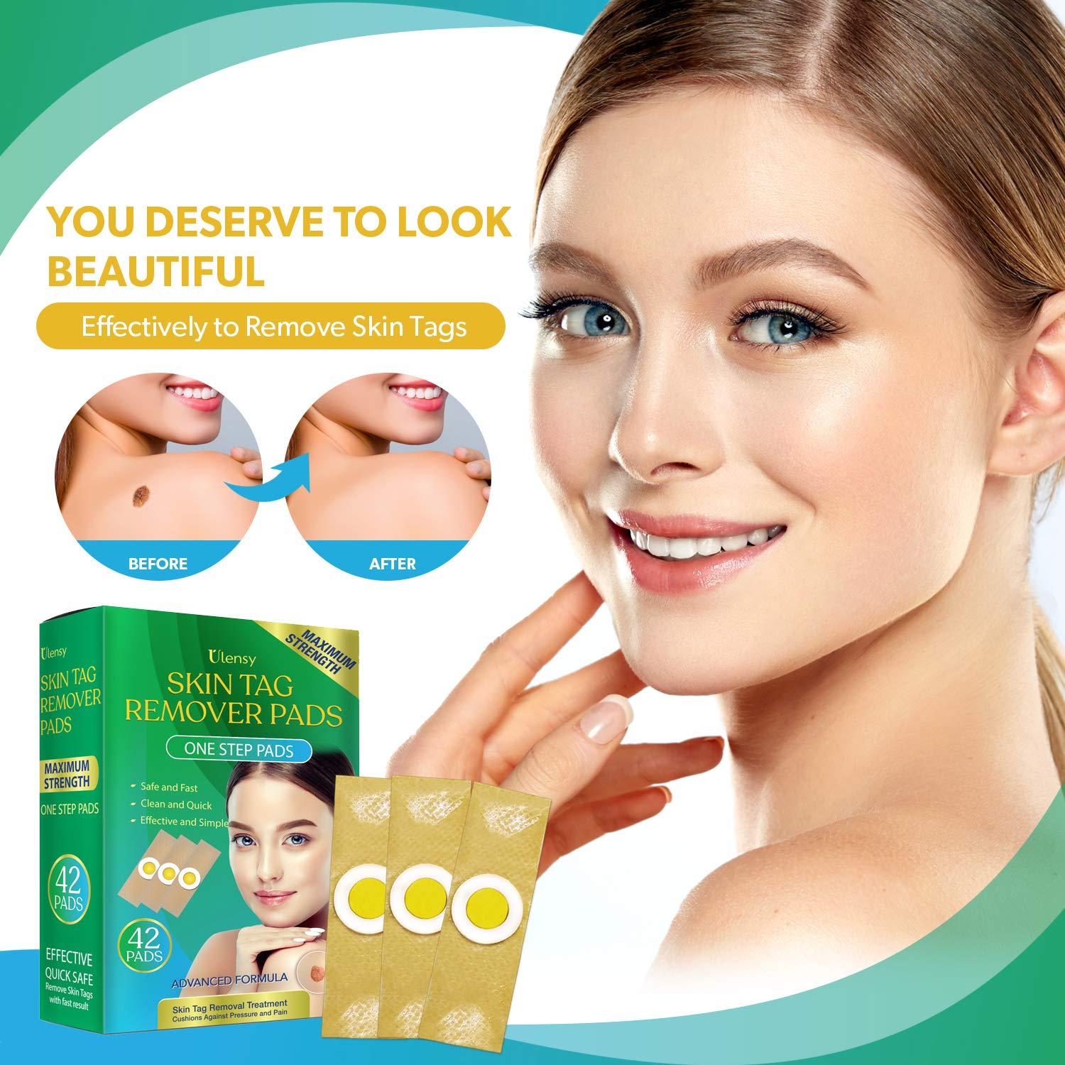 Ulensy 42pcs Skin Tag Remover Pads, FastActing, Comfortable Skin Tag Removal Treatment, Easy to