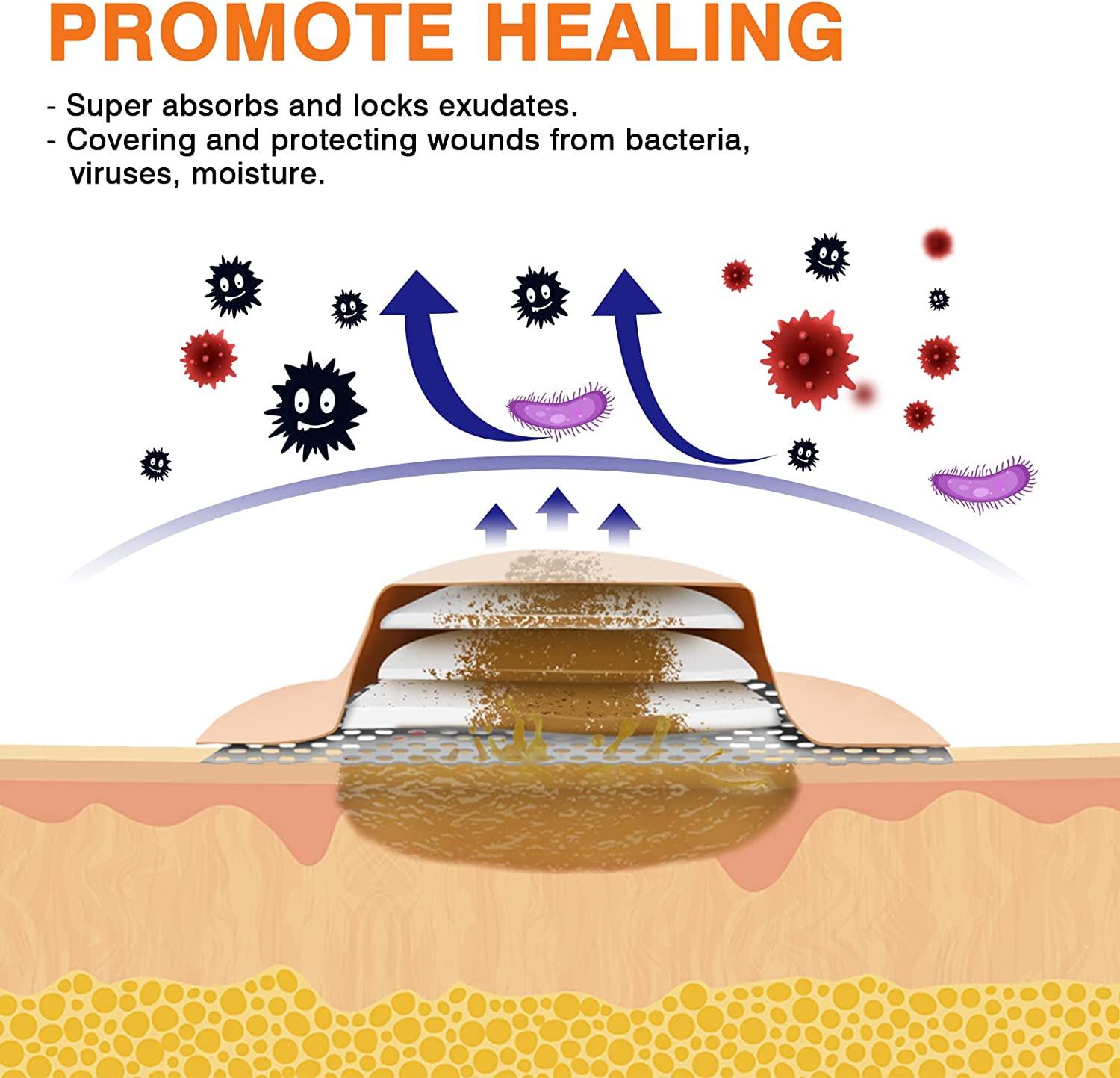 Carbou Sacrum Silicone Foam Dressing with Adhesive Border, 6''x7