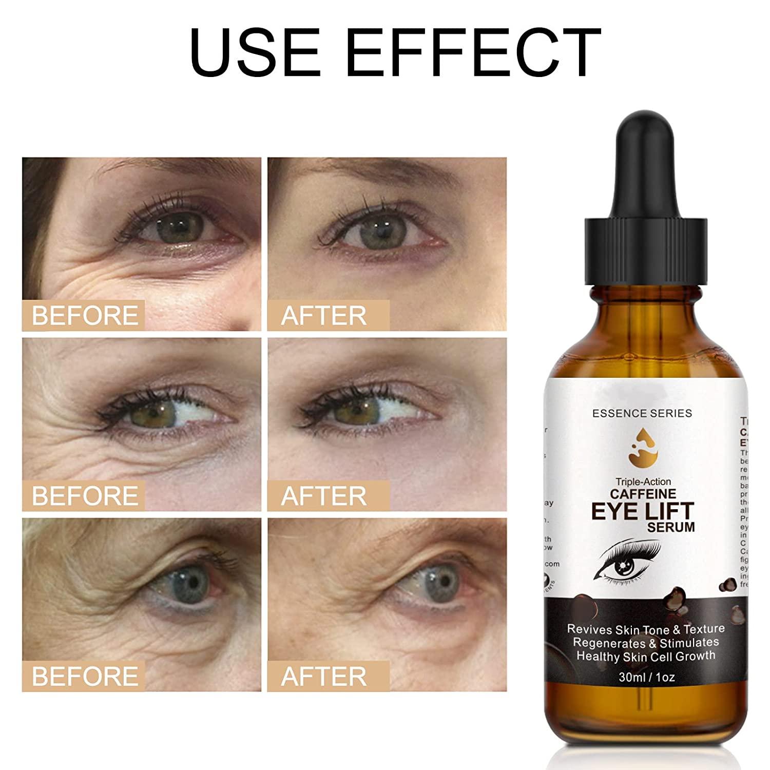 Caffeine Eye Serum with EGCG, Vitamin C, Hyaluronic Acid & Collagen 1