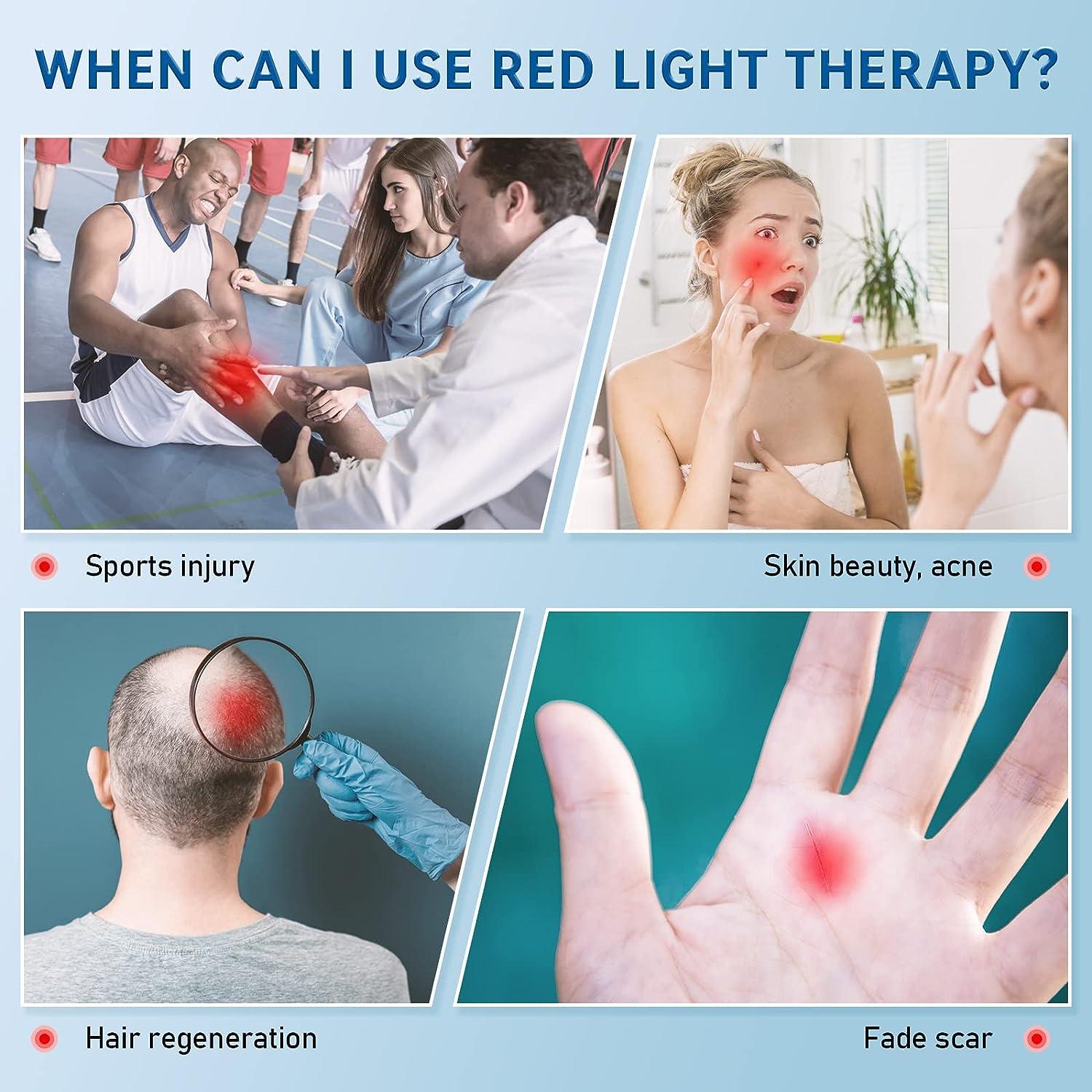 Red Light Therapy Cold Sores Treatment&Fever Blister,Canker Sore Mouth