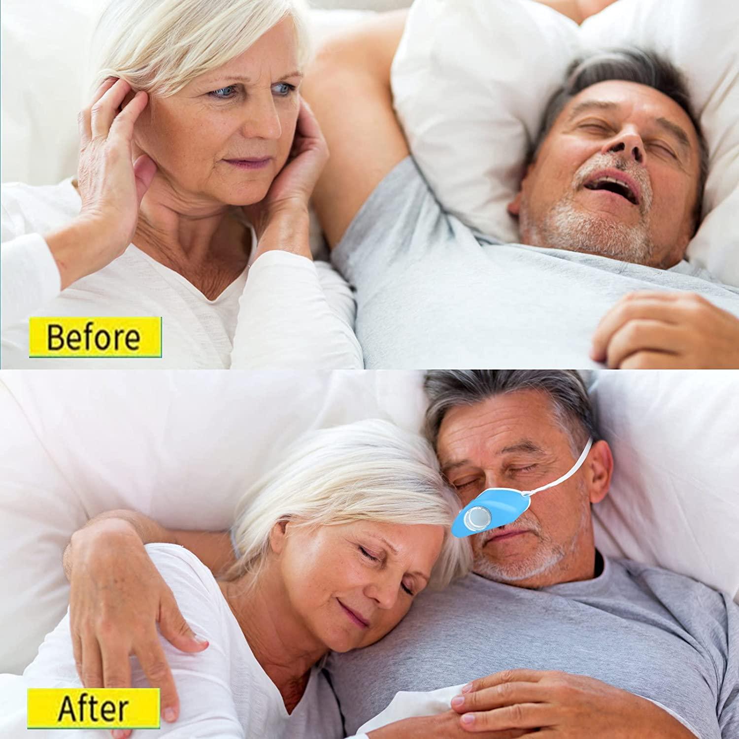 2021 Anti Snoring Device 4in1 Atomization Snoring Solution with PM2