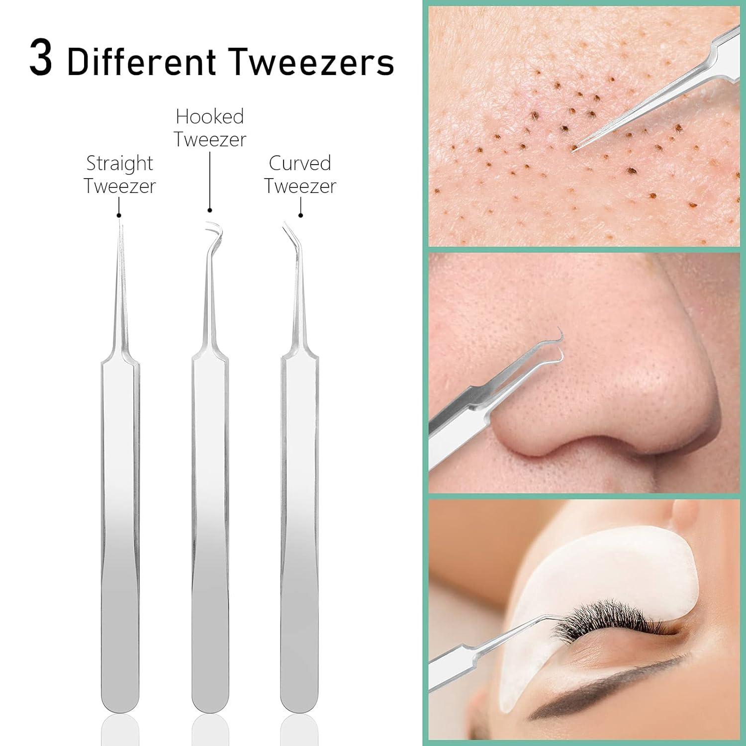 Blackhead Remover Pimple Popper Tool Kit Acne Blemish Pimple Extractor  Needle Facial Comedone Clip Blackhead Tweezer for Ingrown Hair Removal 8  Pcs in Metal Case