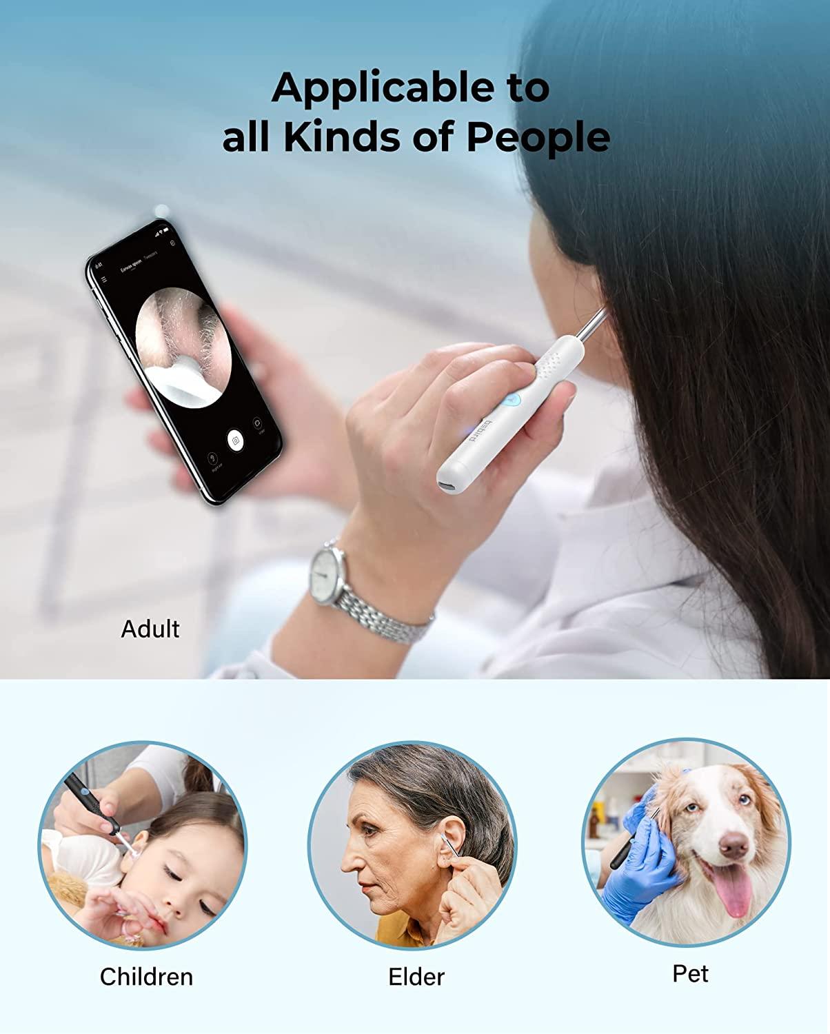 Ear Wax Removal,Bebird Ear Wax Removal Tool Camera,Ear Cleaning Camera