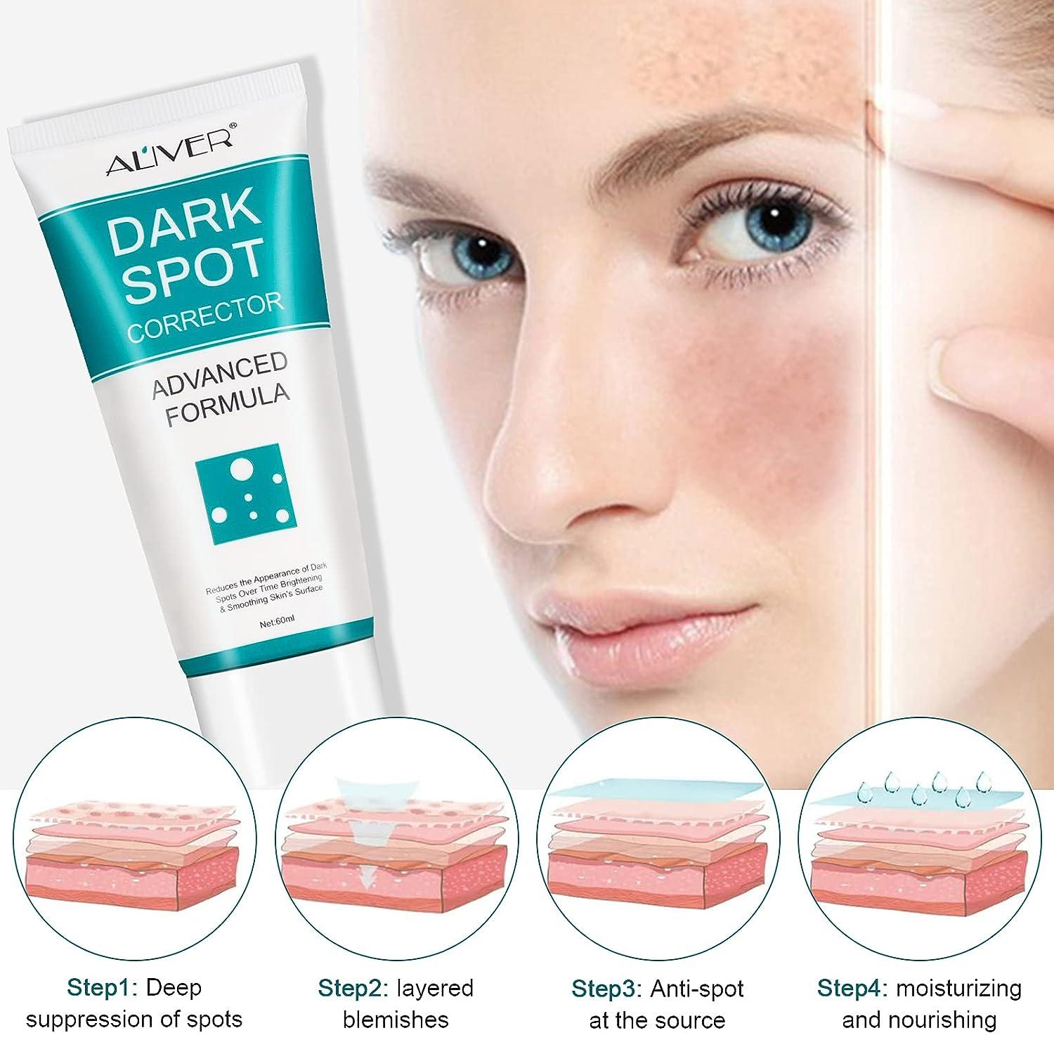 Dark Spot Remover for Face Dark Spot Corrector Cream Fade Out The Skin  Black Precipitate Remove Freckle for Face Fade Spots for All Skin Tone Types