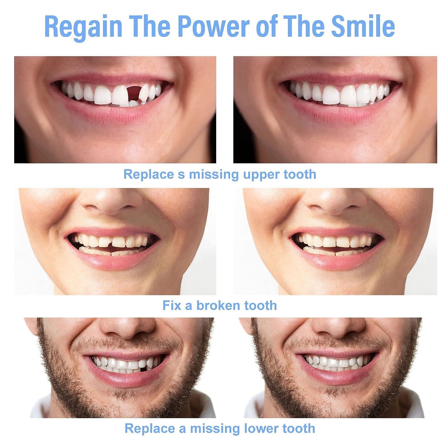 Fake Teeth Repair Kit - Moldable False Tooth for Fixing Broken ...