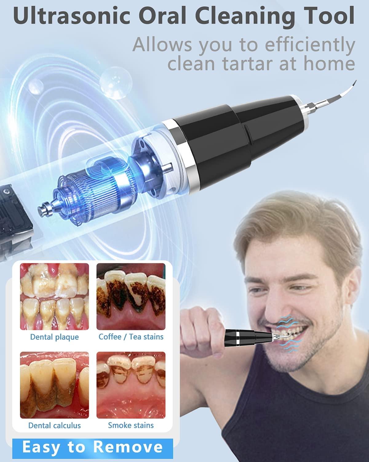 Ultrasonic Tooth Cleaner Plaque Remover for Teeth Remove Teeth Stain
