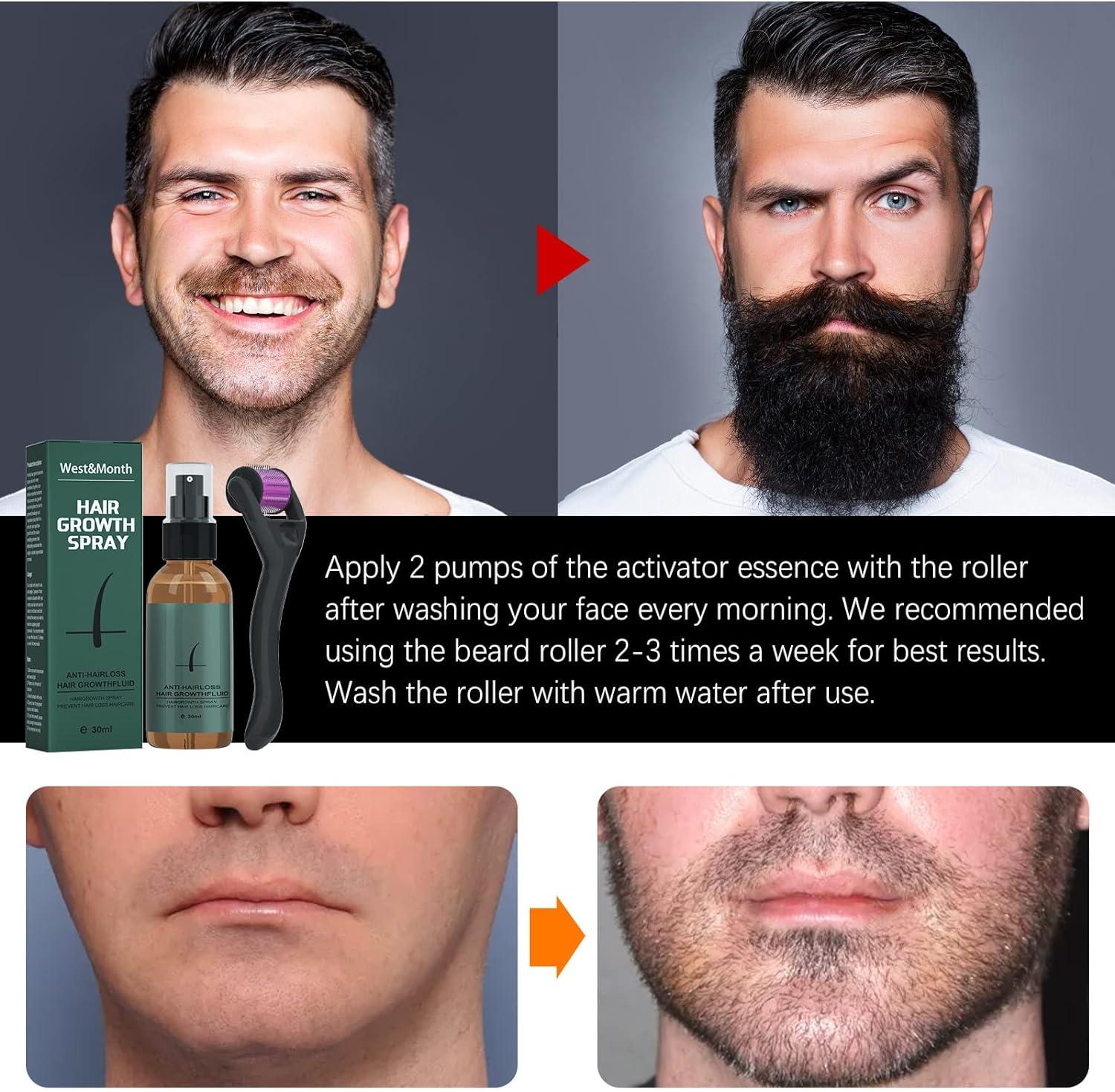 Beard Roller 540 0.5MM Titanium Needles/Derma Roller Hair Growth Men