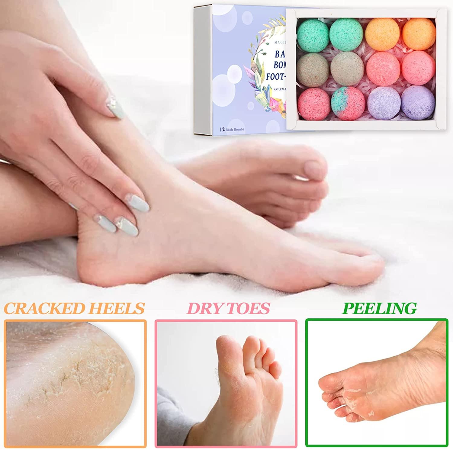 Organic Foot Bath Bombs 12 Pack Rich Essential Oils for Dry, Cracked