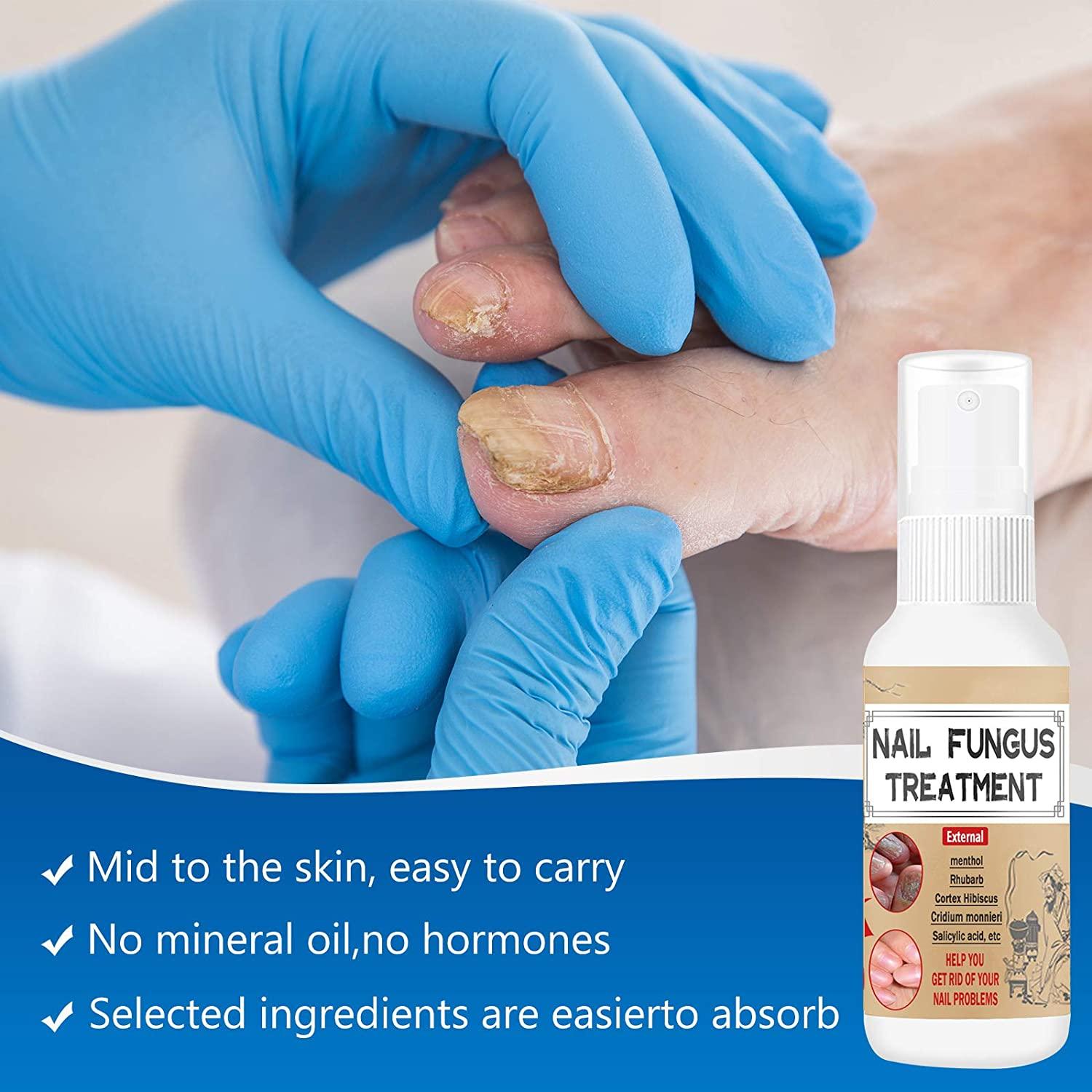 Nail Fungus Treatment for Toenail, Effective Toenail Fungus Treatment