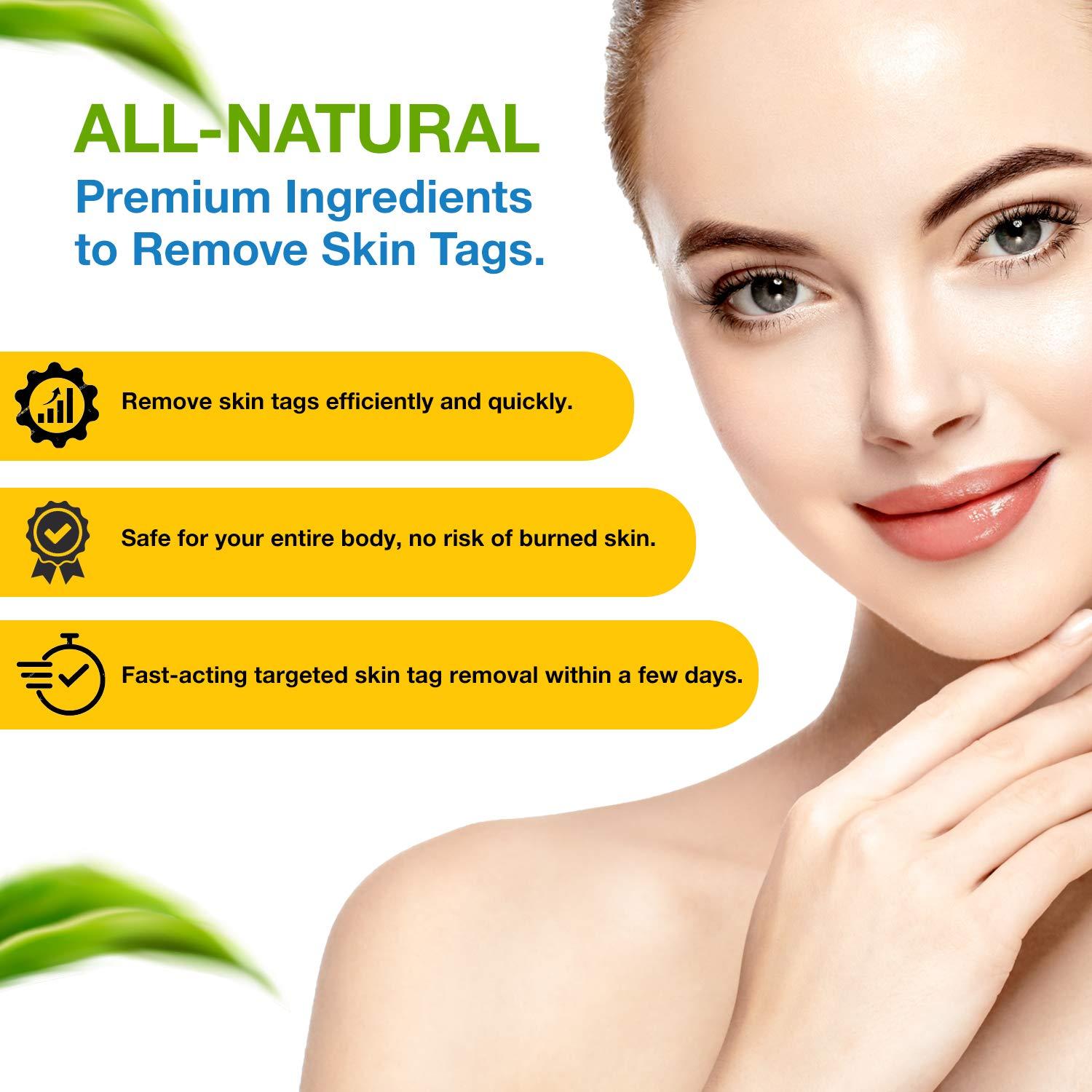 Ulensy Skin Tag Remover Extra Strength Liquid for Fast, PainFree