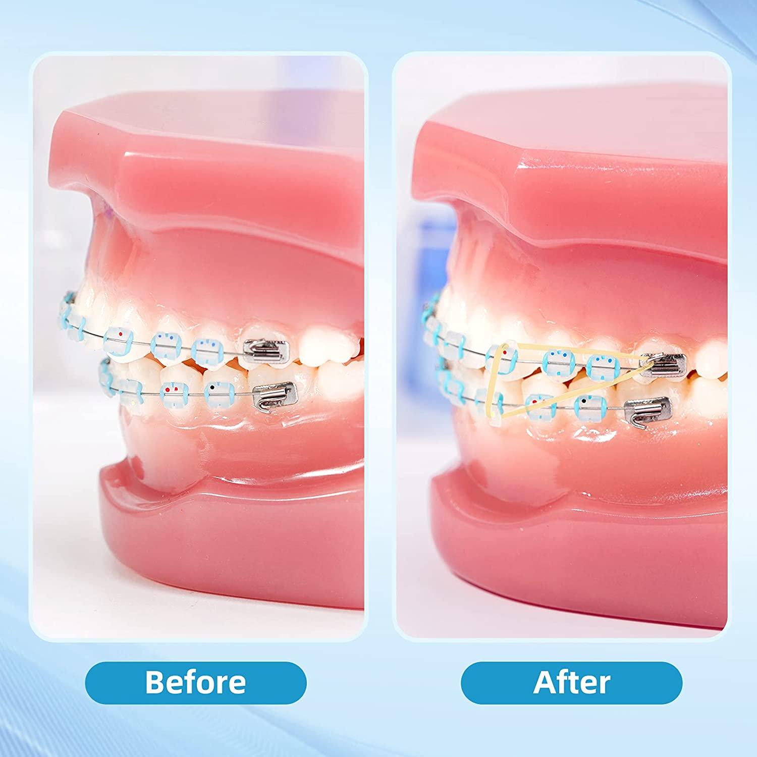 500 Pcs Orthodontic Elastic Rubber Bands 4.5 Oz 1/4 Size Dental Rubber Bands for Teeth Gap