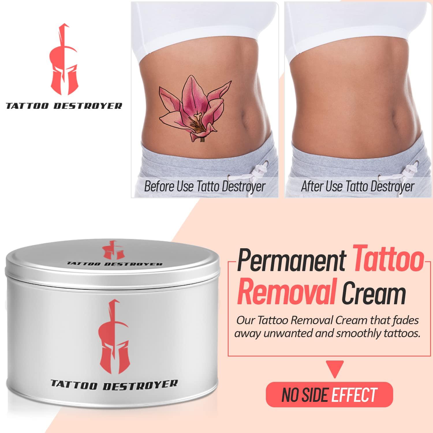 Best Tattoo Removal Creams 2022: Reviews of Tattoo Fading Cream, Balm