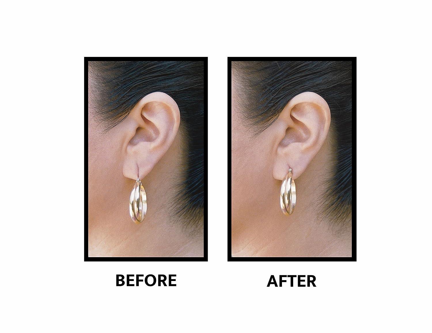LOBE WONDER Ear Lobe Support Patches
