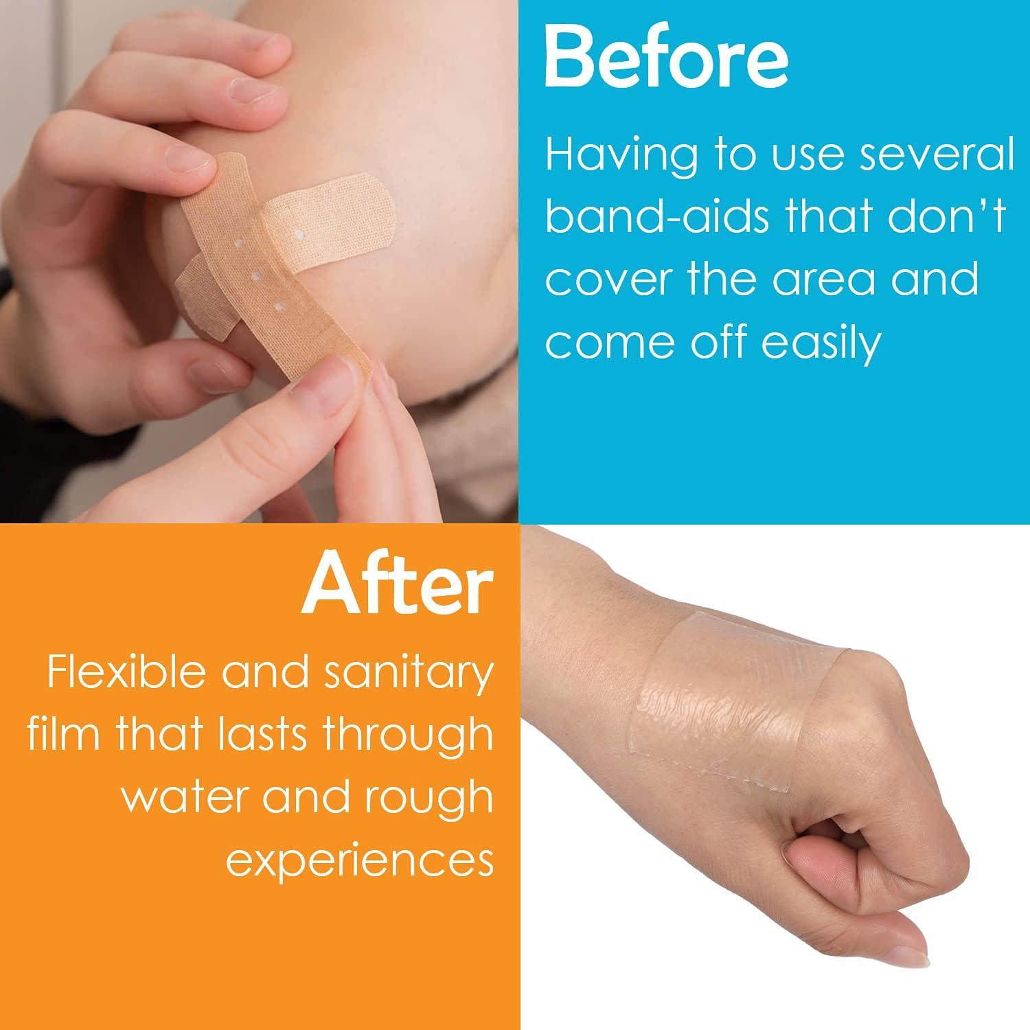 Houseables Silicone Scar Sheets Treatment Tape 1.57 x 59 with 2