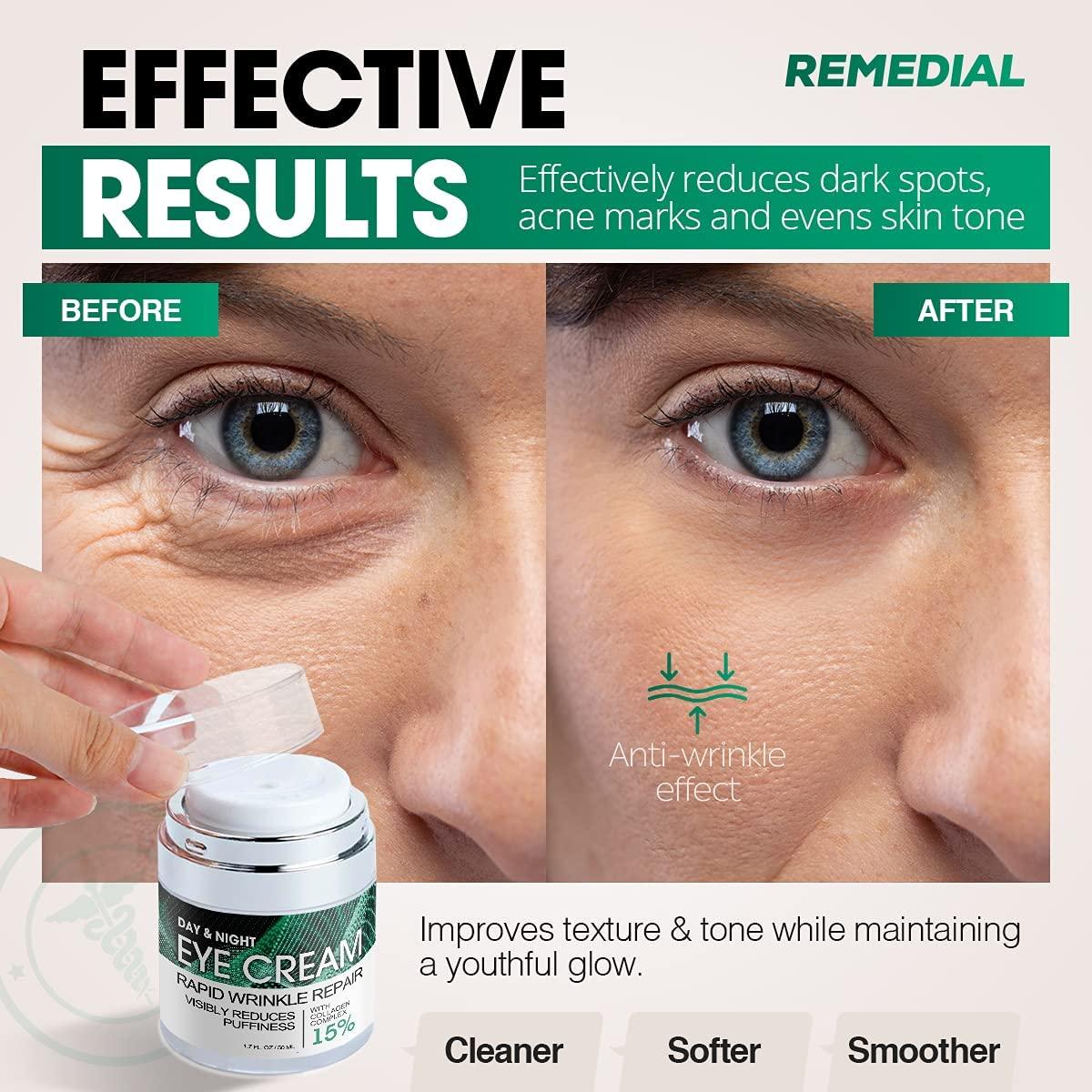 Eye Cream for Dark Circles Wrinkles Puffiness and Bags Under Eyes