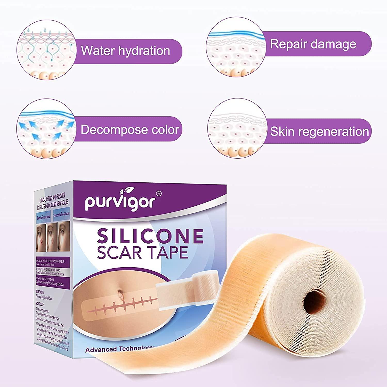 MOMEI Silicone Scar Sheets Soft Gel Tape for Removal (1.6 inch x 60