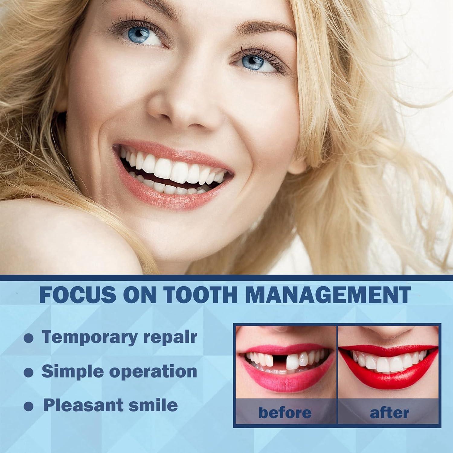 Tooth Filling Kit Temporary Tooth Filling Kits with 5 Tooth Tools Moldable Fake Teeth Beads for