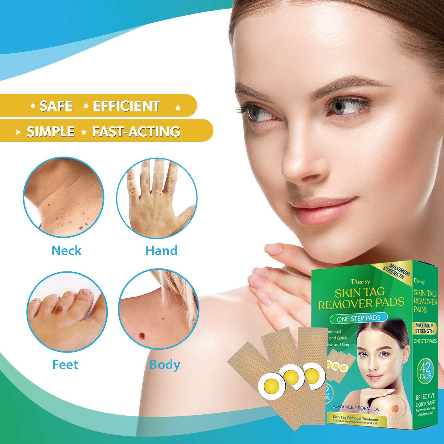 Ulensy 42pcs Skin Tag Remover Pads, FastActing, Comfortable Skin Tag Removal Treatment, Easy to