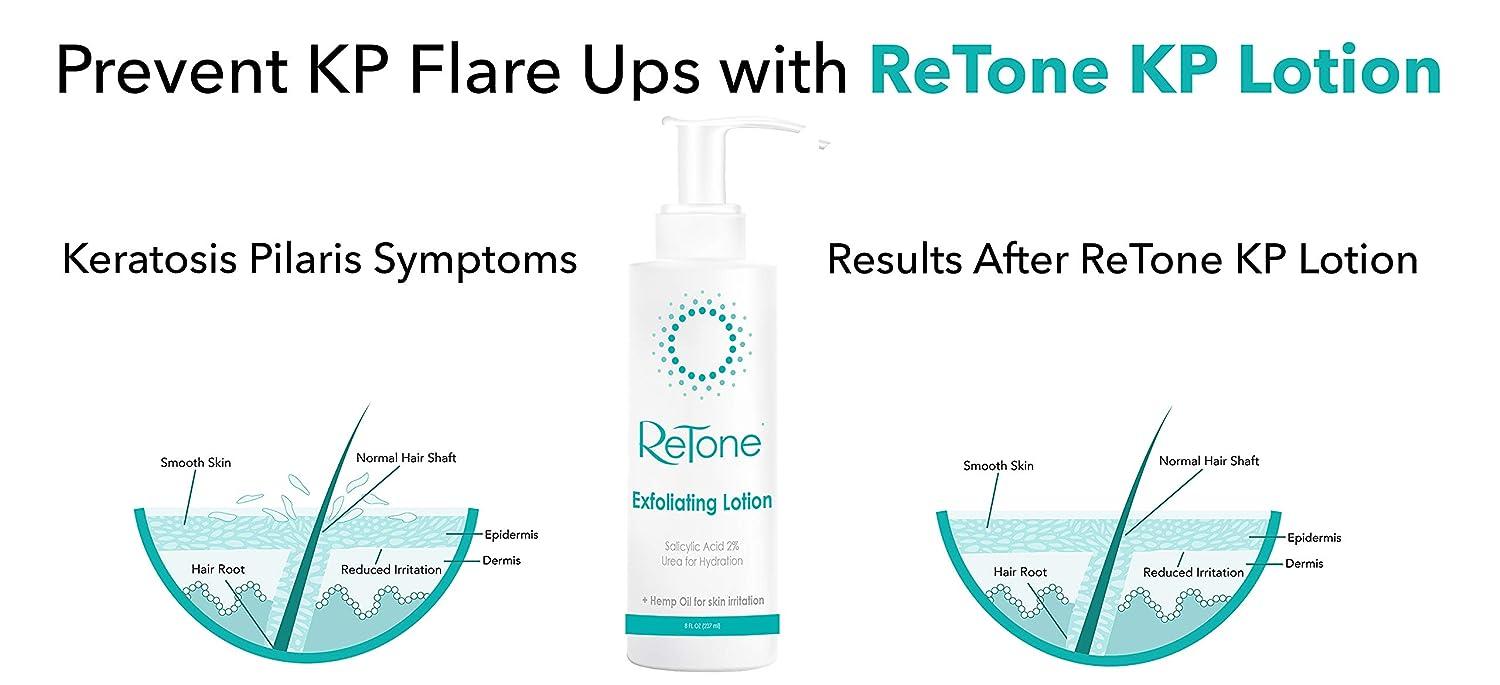 ReTone Keratosis Pilaris Exfoliating Body Lotion KP treatment Body