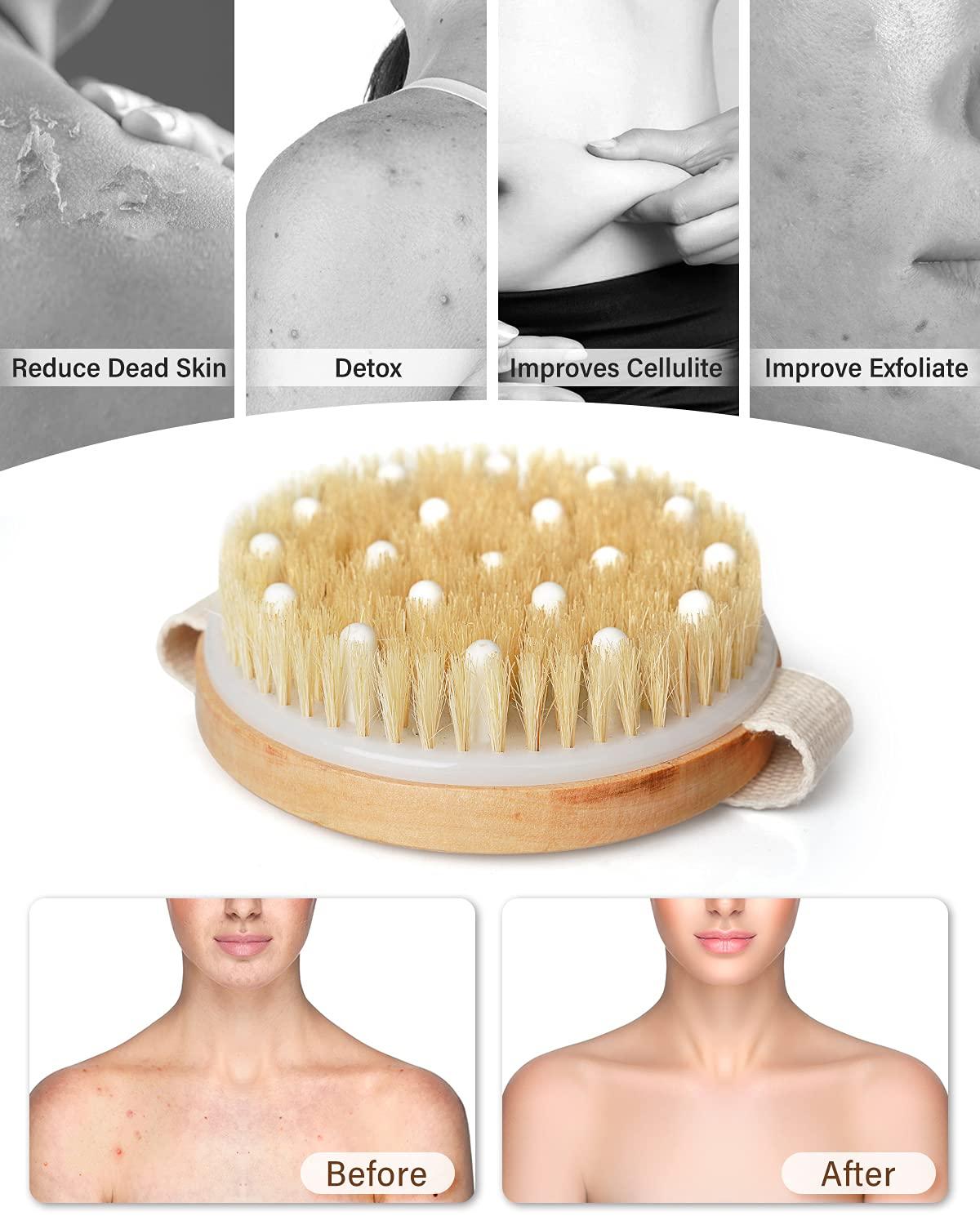 POPCHOSE Body Exfoliator Dry Brush, Dry Brushing Exfoliating Body Brush for  Dry Skin, Cellulite and Lymphatic Drainage, Blood Circulation Improvement  with Natural Bristles Massage Nodules