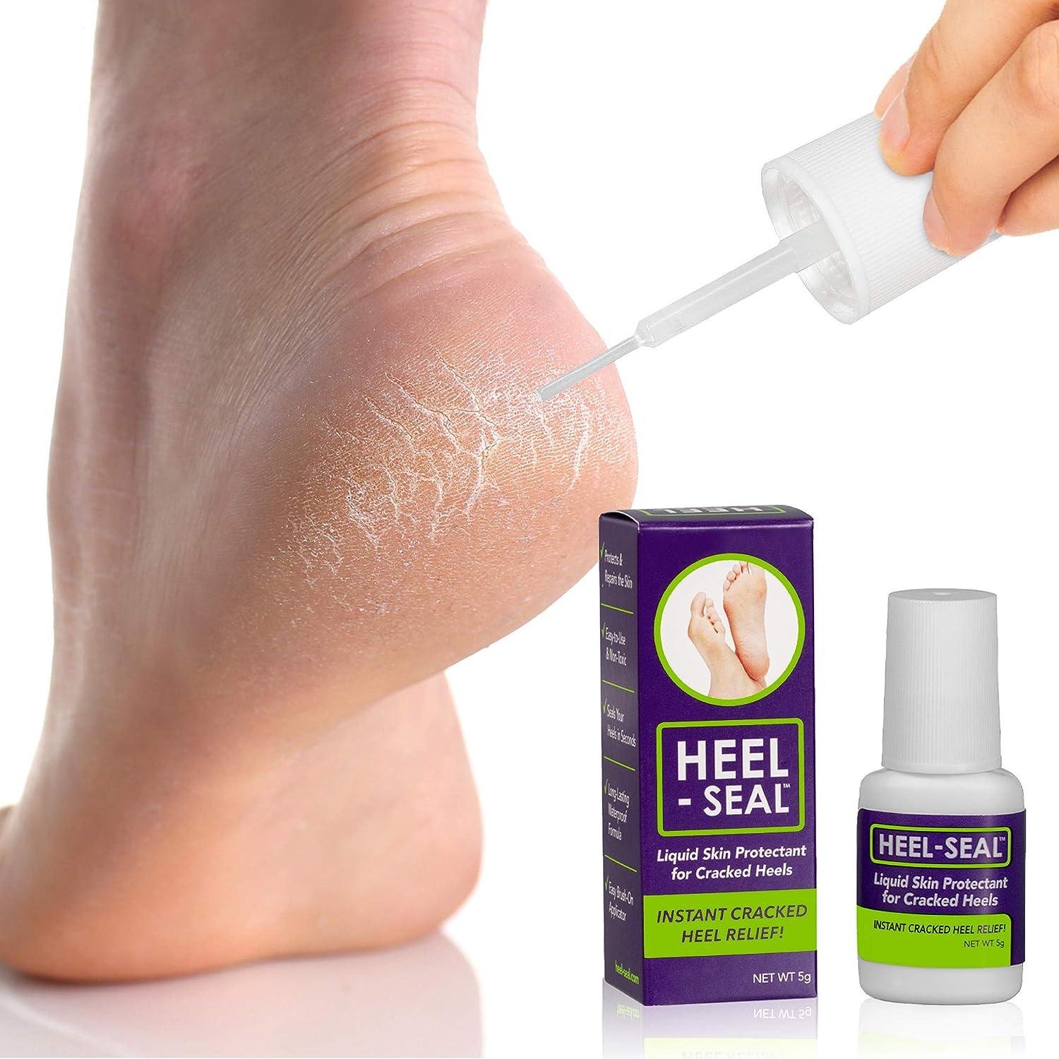7 Best And Easy Home Remedies To Soften Cracked Heels
