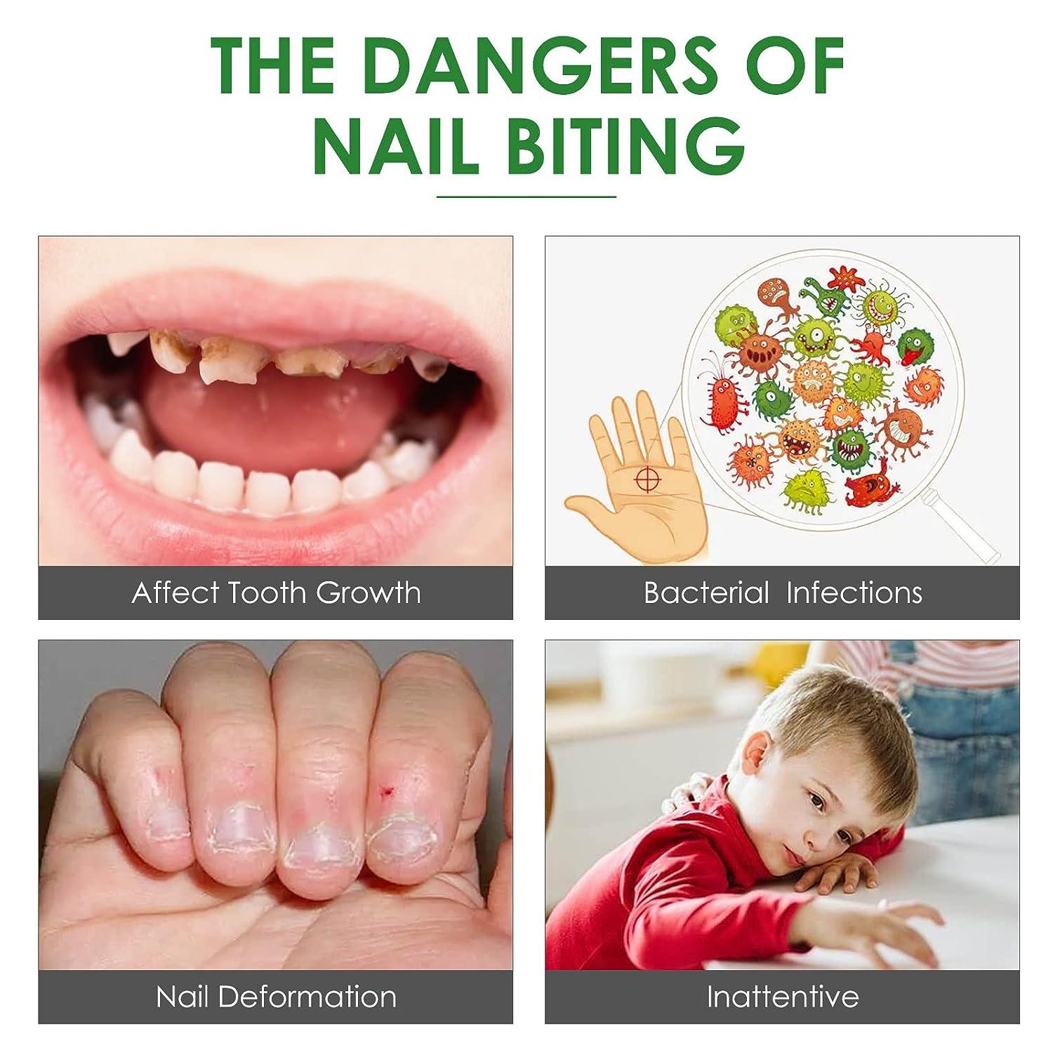 How to stop biting your nails - YouTube