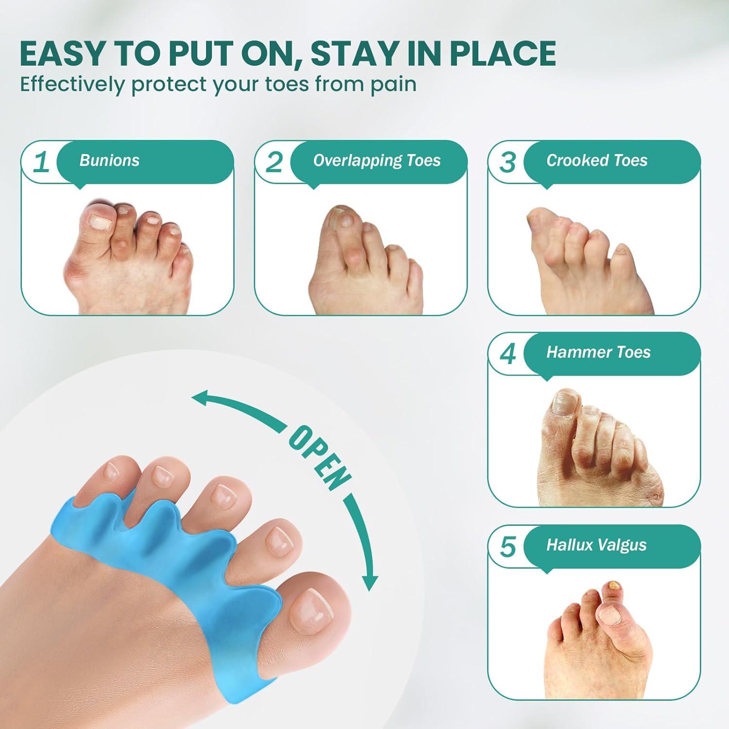 Toe Separators to Correct Your Toes - 4 Pcs Gel Toe Spacers for Overlapping  - Hammer Toe Straighteners for Women Men - Bunion Correct Restores Your Toes  Shape