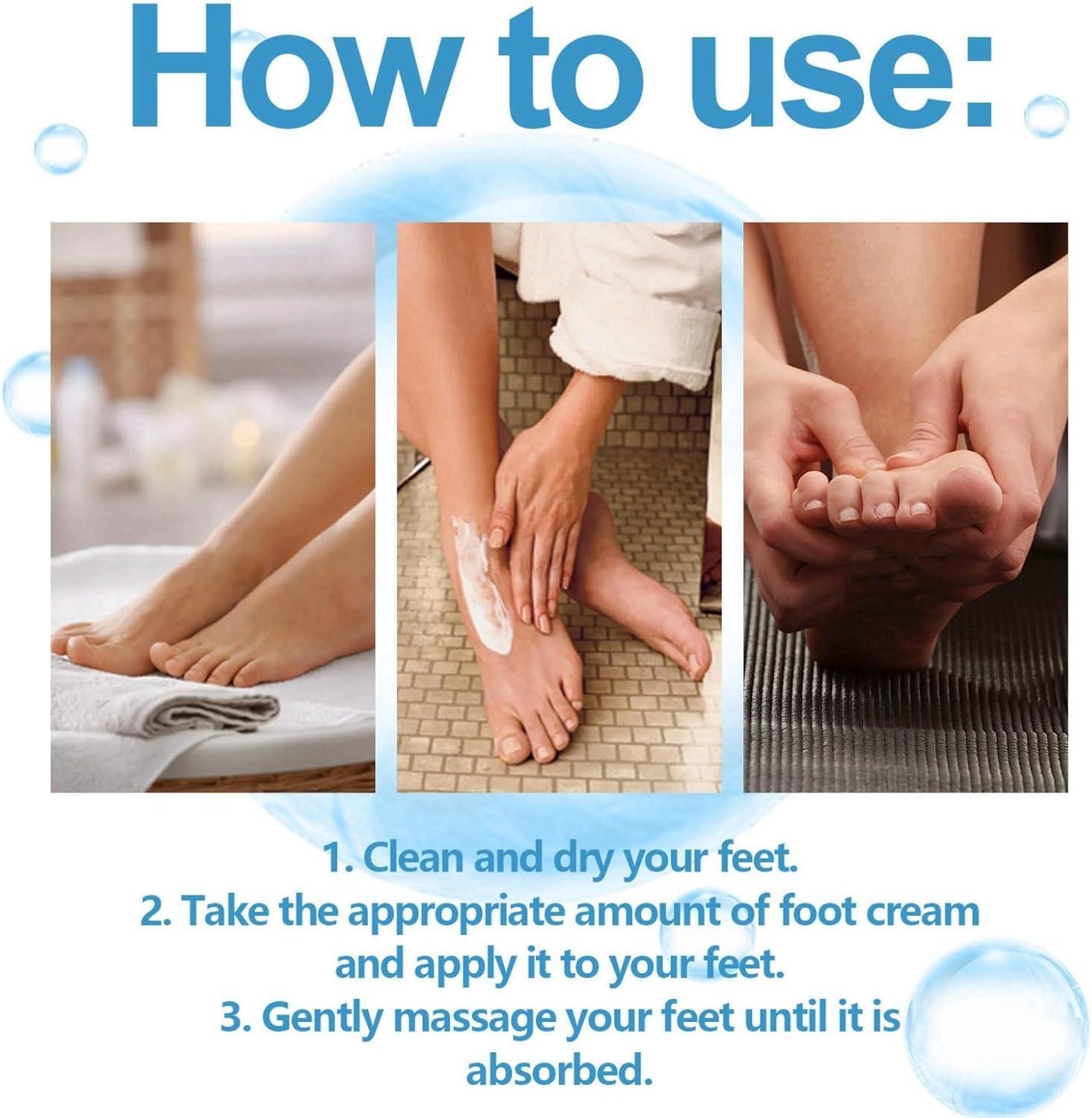 42% Urea Foot Cream Urea Cream 42 Percent for Feet Cracked Heel
