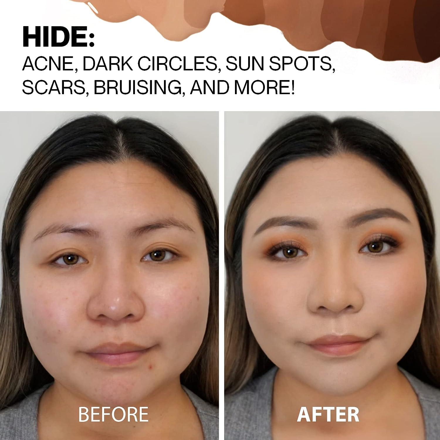 Full Erage Concealer Makeup For Acne