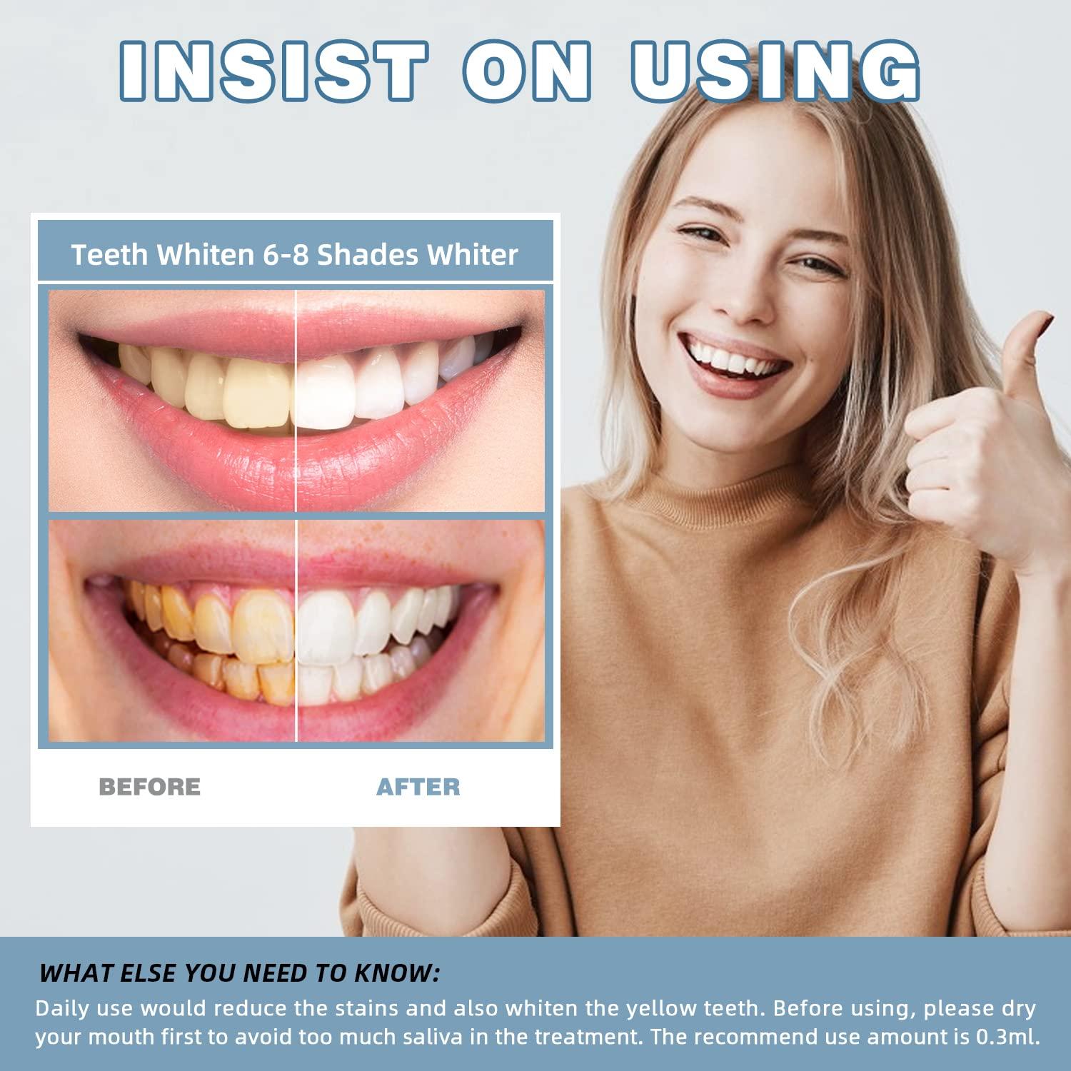 Teeth Whitening Kit with LED Light Accelerator at Home, with New