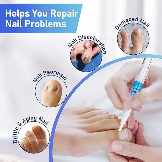 Warning! This DIY nail manicure can you an allergic reaction