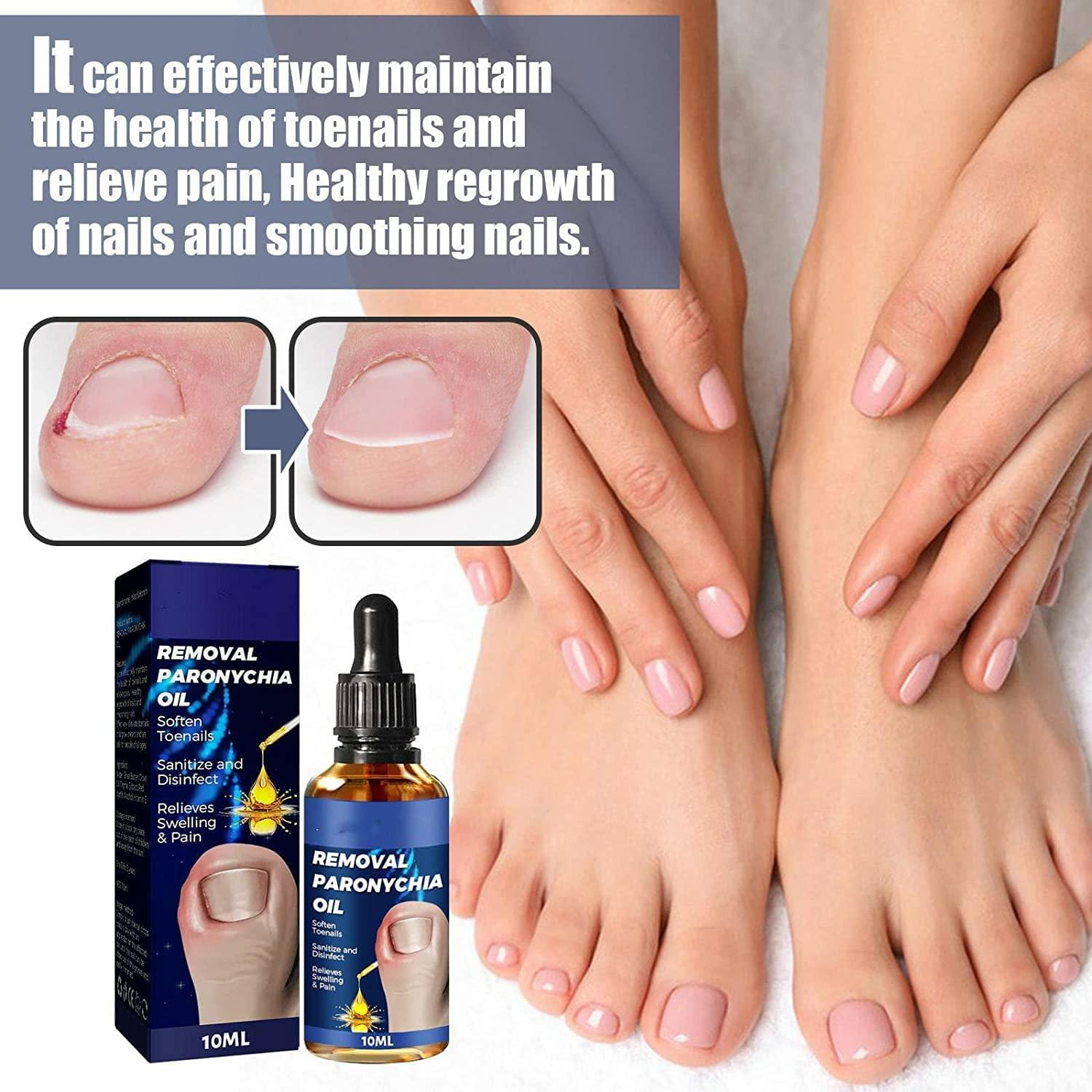 German Toenailcare Removal Paronychia Oil, Nail Renewal Liquid for