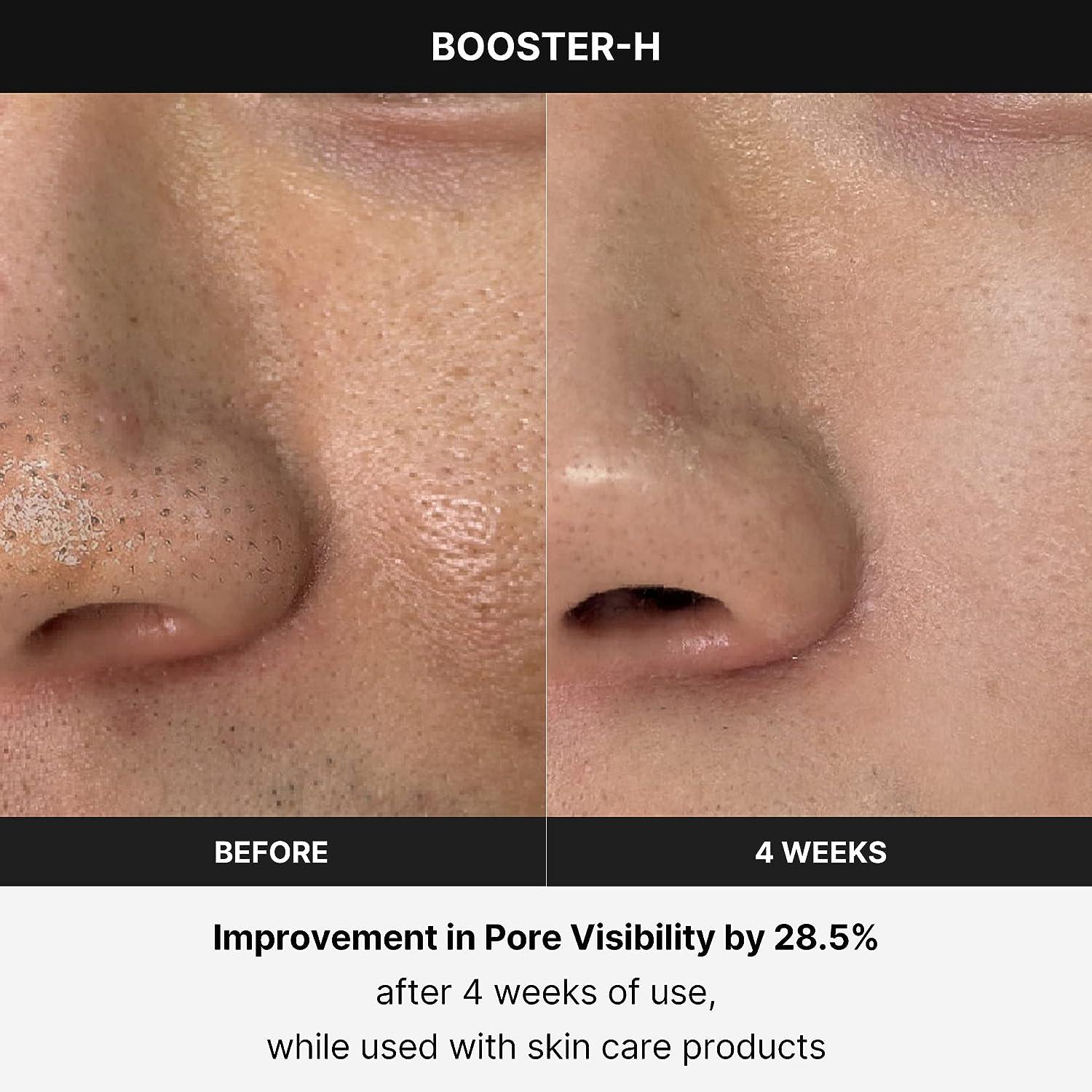 Medicube AGE-R BOOSTER-H 新品未使用 Medicube AGE-R Booster-H ME-BSTH Home Skin Care Beauty