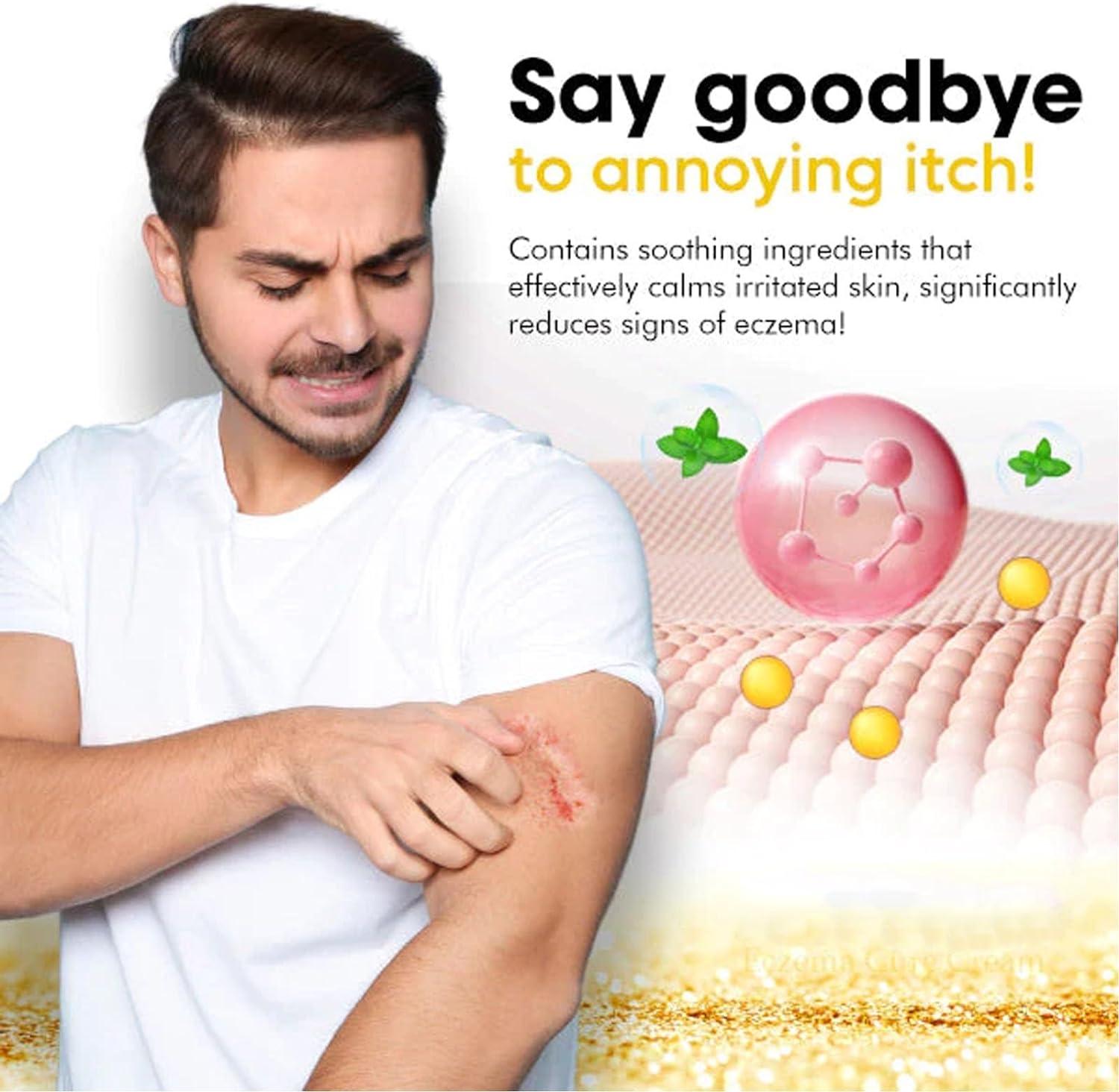 Eczema and Psoriasis Relief Cream Set Soothes Irritated Skin, Treats