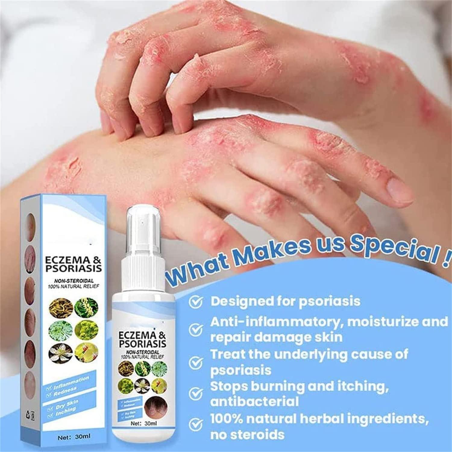 Herbal Psoriasis, Eczema, and Vitiligo Relief Spray Trio Skin Repair