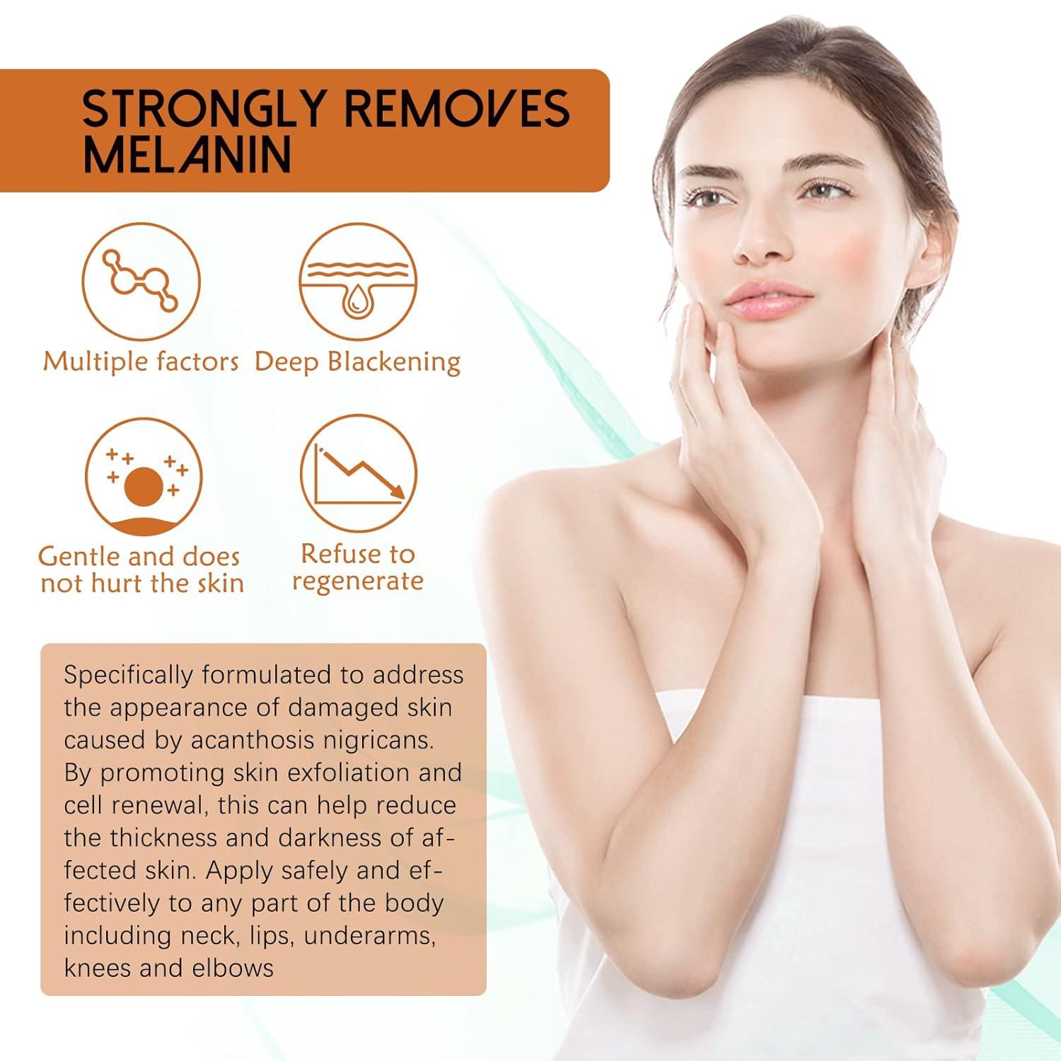 Fulvtuy JAYSUING Acanthosis Nigricans Therapy Oil Reduces Dark Spots