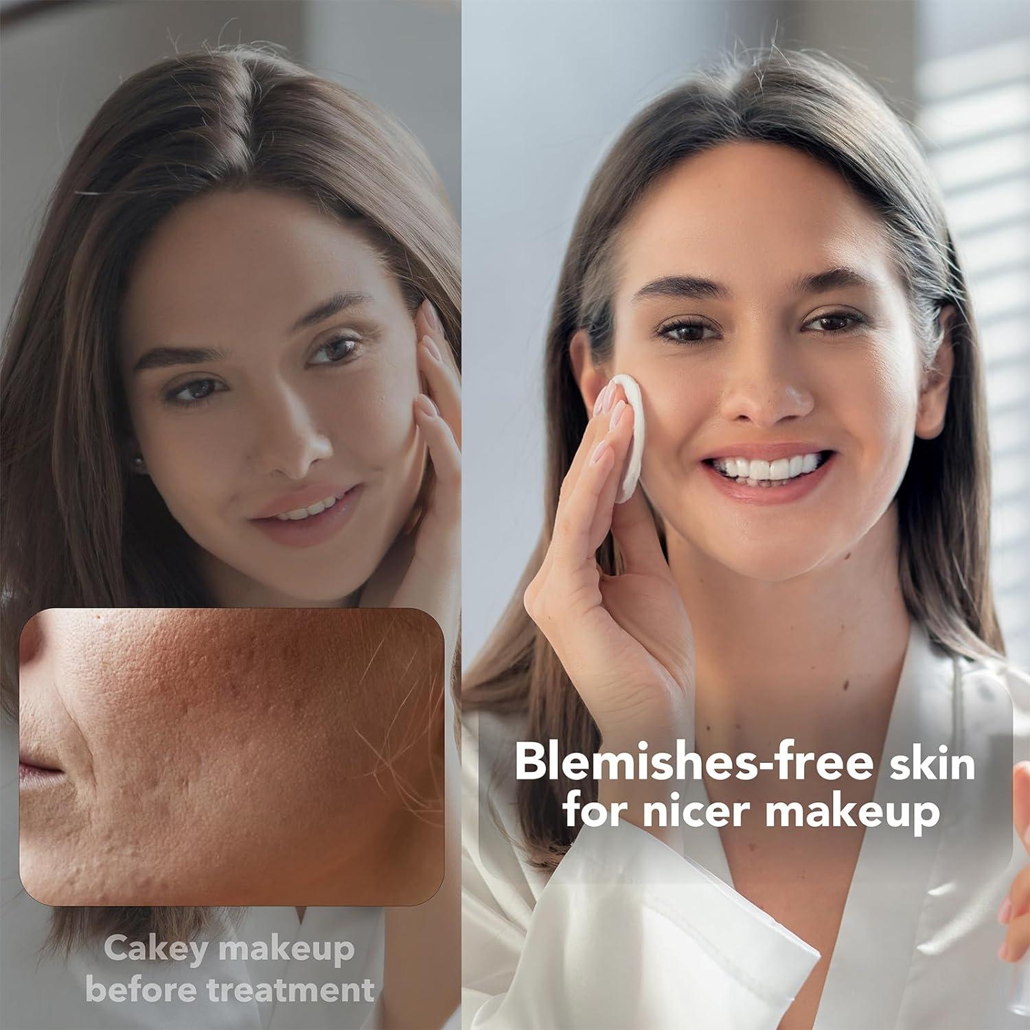 NEWKEY LED Face Mask for Acne Reduction - 7 Color Light Therapy for ...