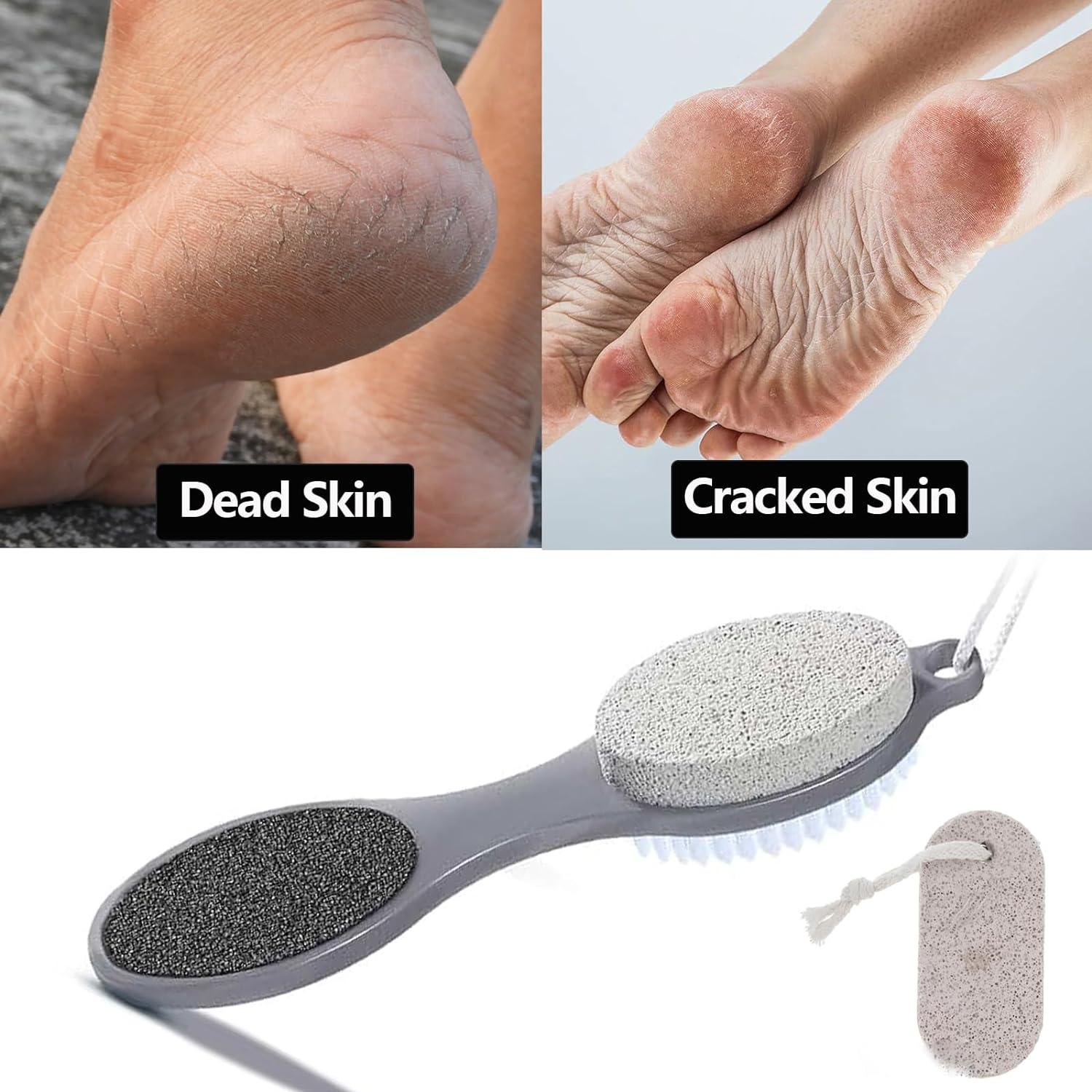 Pumice Stone for Feet with a Stone Foot Scrubber Pumice Stone Foot