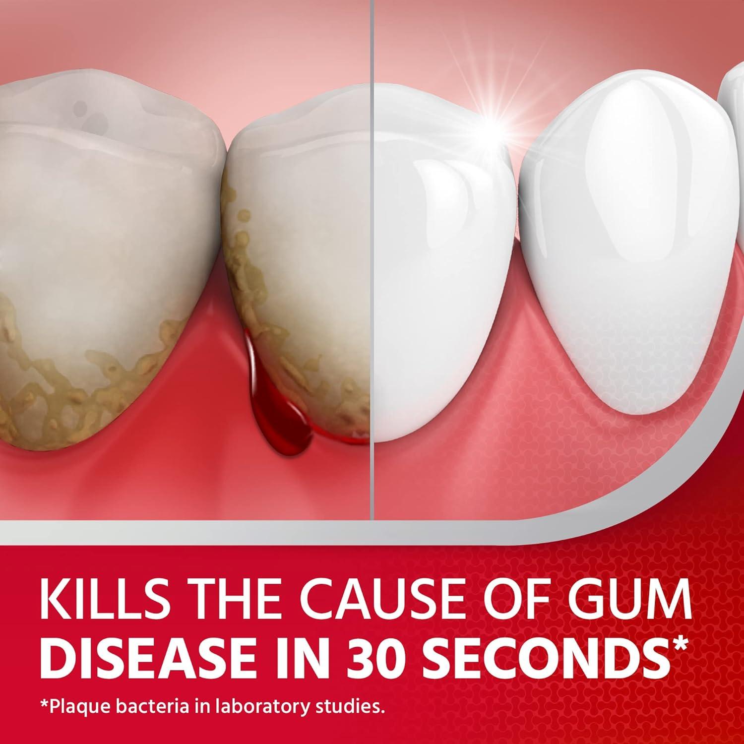 Corsodyl Gum Disease & Bleeding Gum Treatment Antibacterial Mouthwash