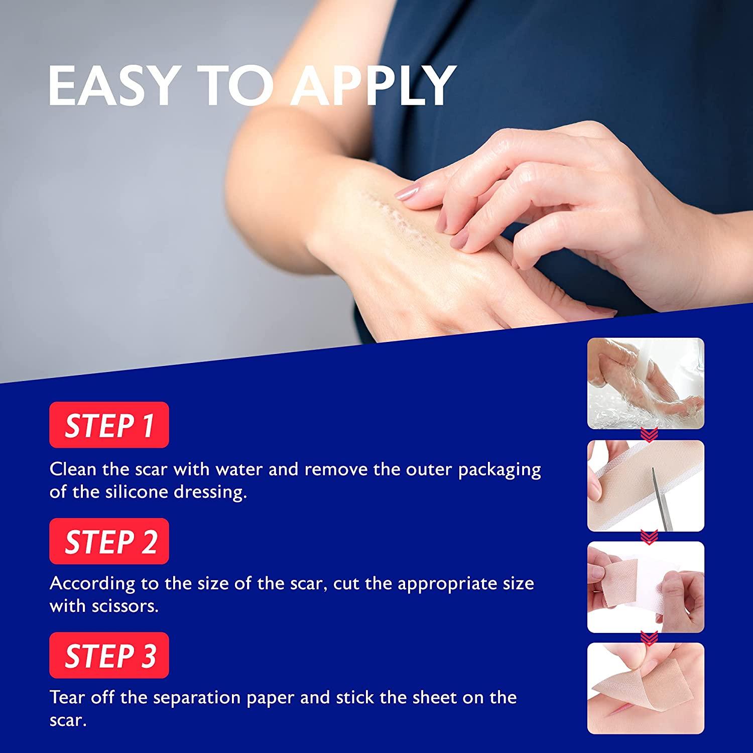 Beautivity Advanced Scar Removal Silicone Tape for Hypertrophic Scars