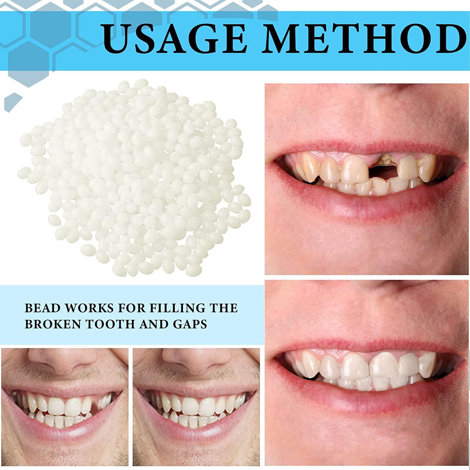 Fake Teeth for Missing Teeth Temporary Tooth Replacement Repair Kit Temp  Tooth Veneer Crown Tooth Replacement It Yourself Front Teeth Dental Veneer  with Thermal Beads for Holiday Cosplay (100 Pieces)