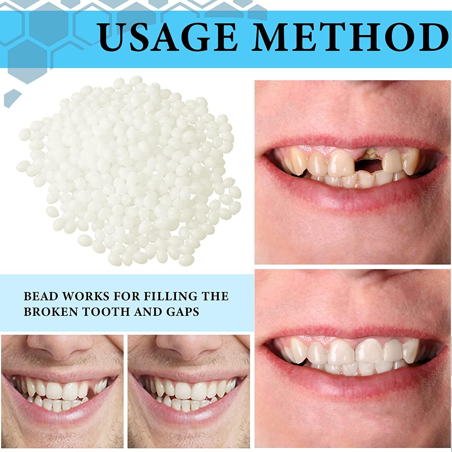 Fake Teeth for Missing Teeth Temporary Tooth Replacement Repair Kit