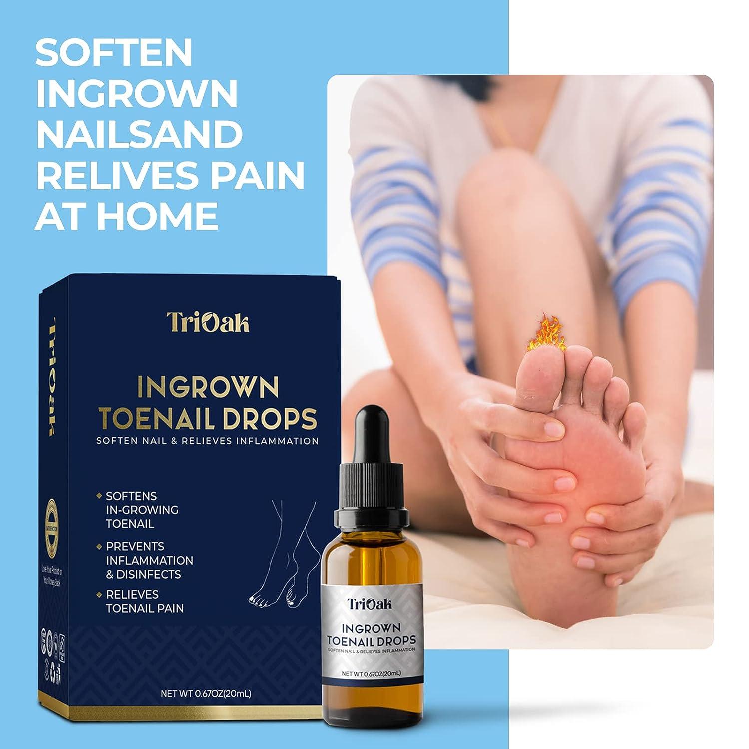 TriOak Ingrown Toenail Drops Ingrown Toenail Removal Kit Ingrown