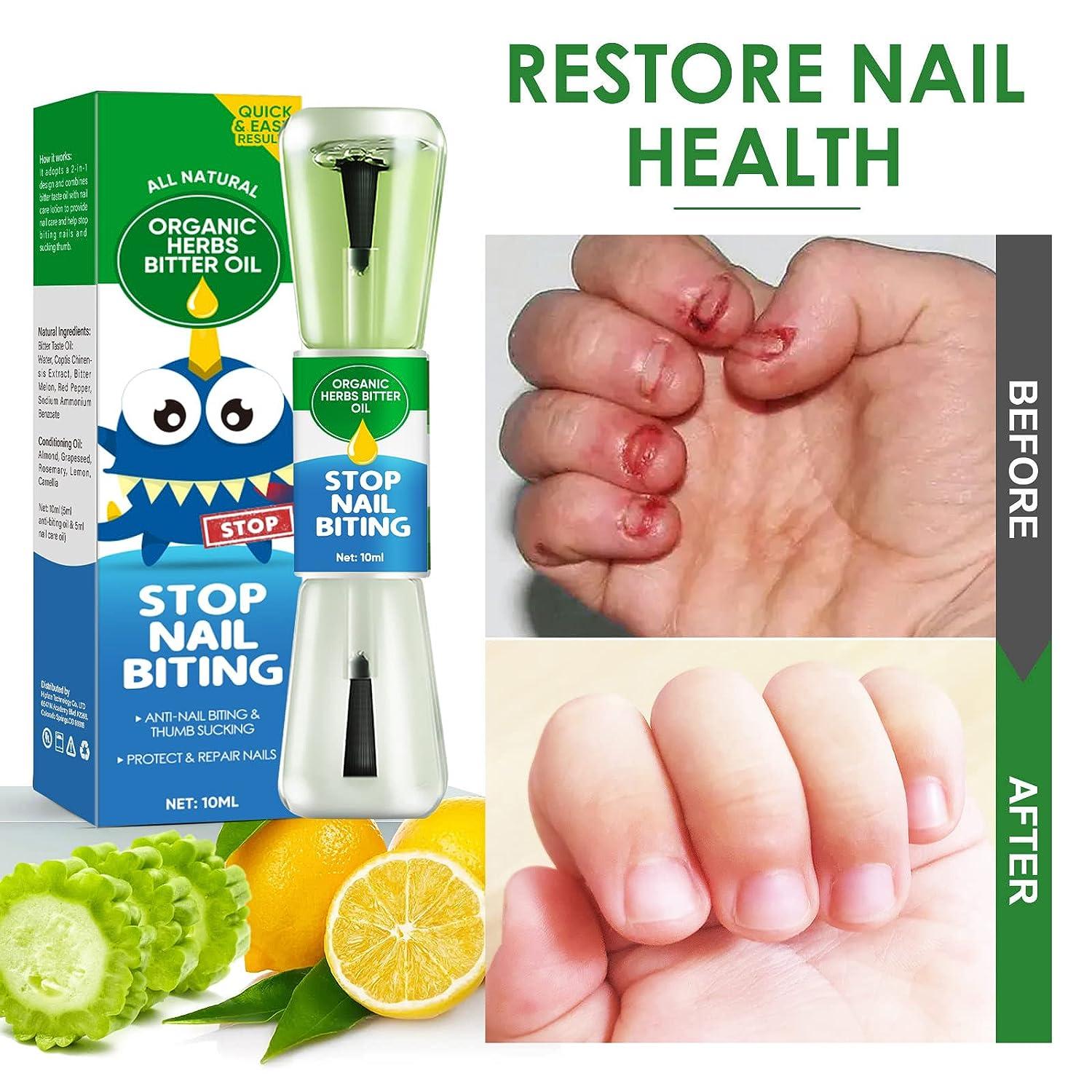Bitter Nail Polish Liquid - Stop Chewing & Thumb Sucking - Effective Anti- nail Chewing Polish For Children And Adults | Fruugo MY