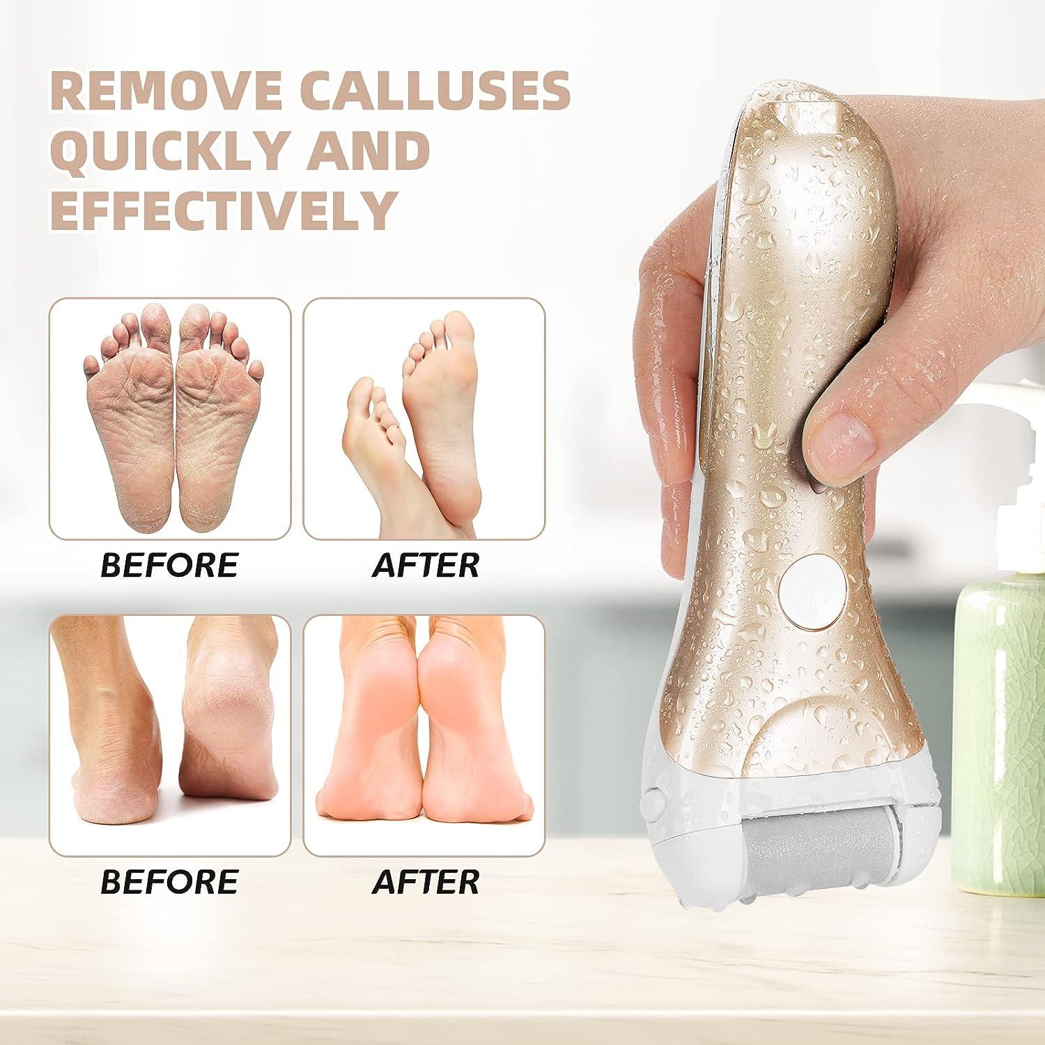 Callus Remover for Feet, Nicebirdie Electric Foot File Callus Removers