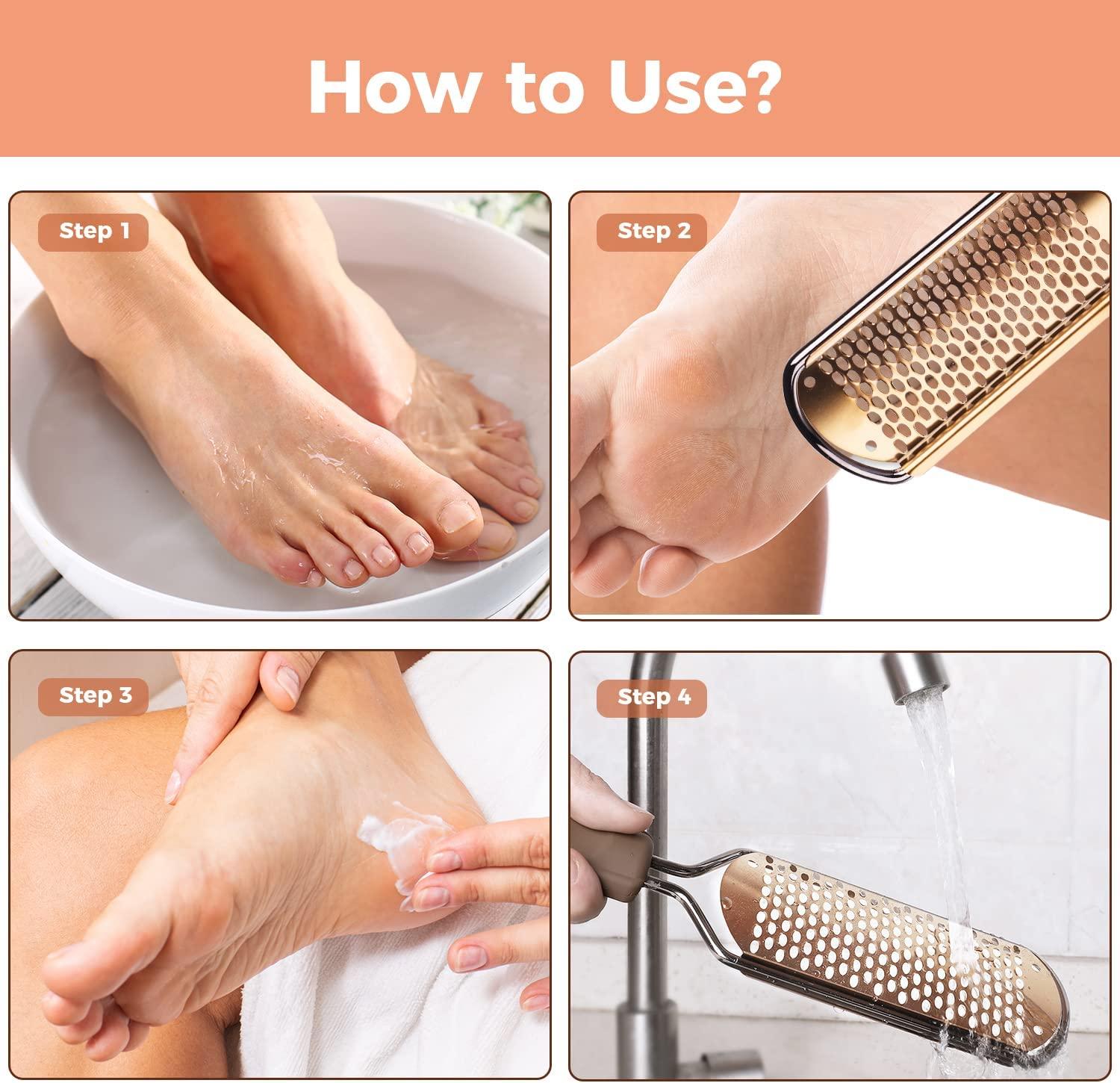 Foot File Foot Scrubber Pedicure - Callus Remover for Feet Easkep  Professional Foot Grater Rasp Foot Scraper Corns Callous Removers Dry skin  Cracked Dead Skin Remover for Dry and Wet Feet (Golden)